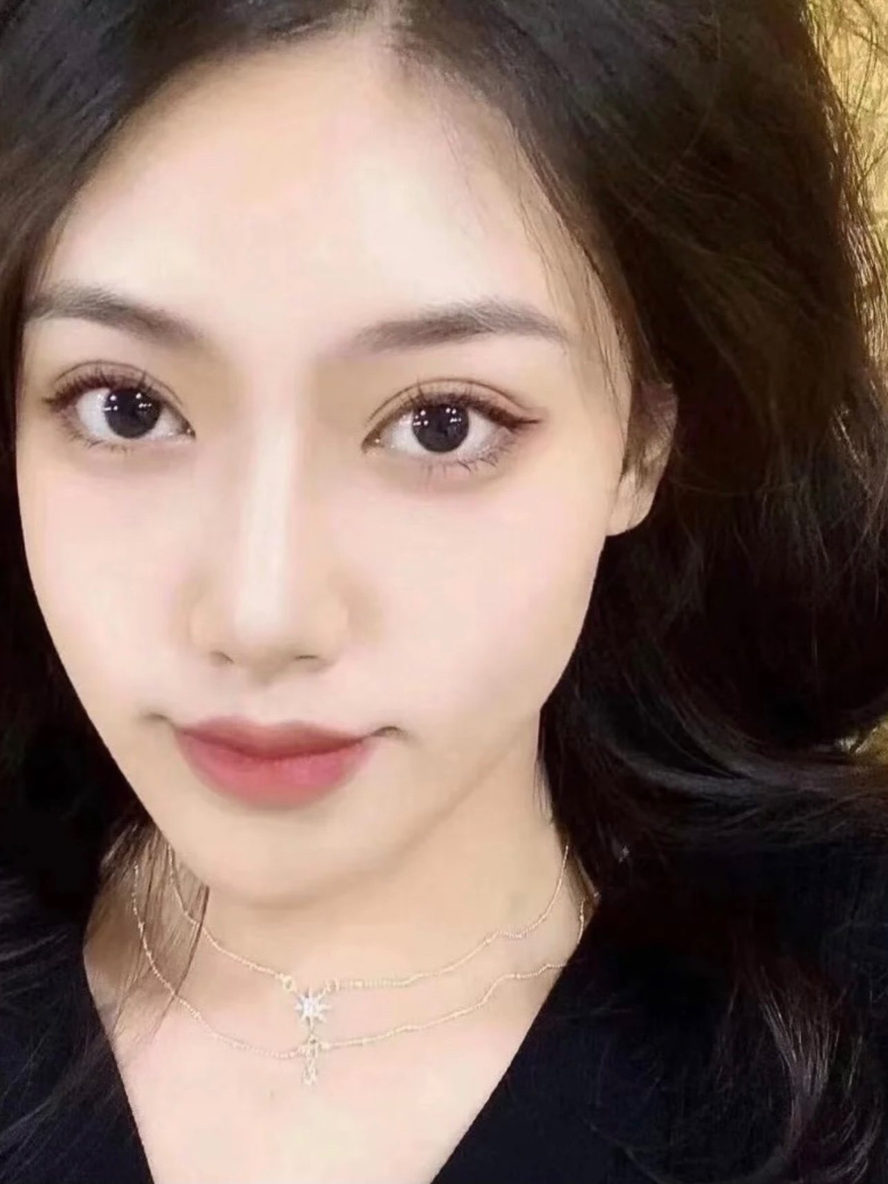 值得信赖,解答全面,专业鼻子做的真好看小巧又精致术_圈子-新氧美容