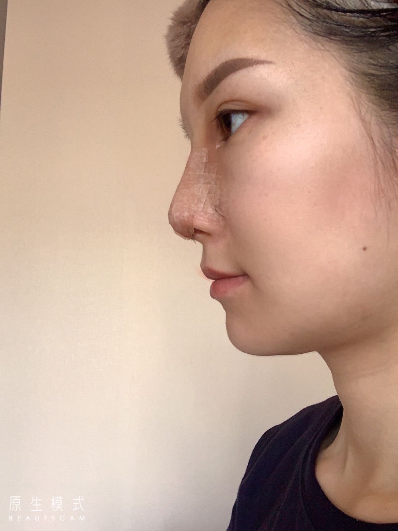 拥有一个好看的鼻子,是每个女孩子的梦想吧,亚洲人普遍鼻型不好看