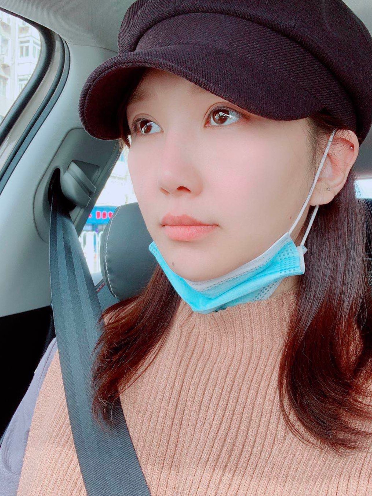 做完单萌芽鼻已经三十天了,第一个恢复月过去了,外表_圈子-新氧美容