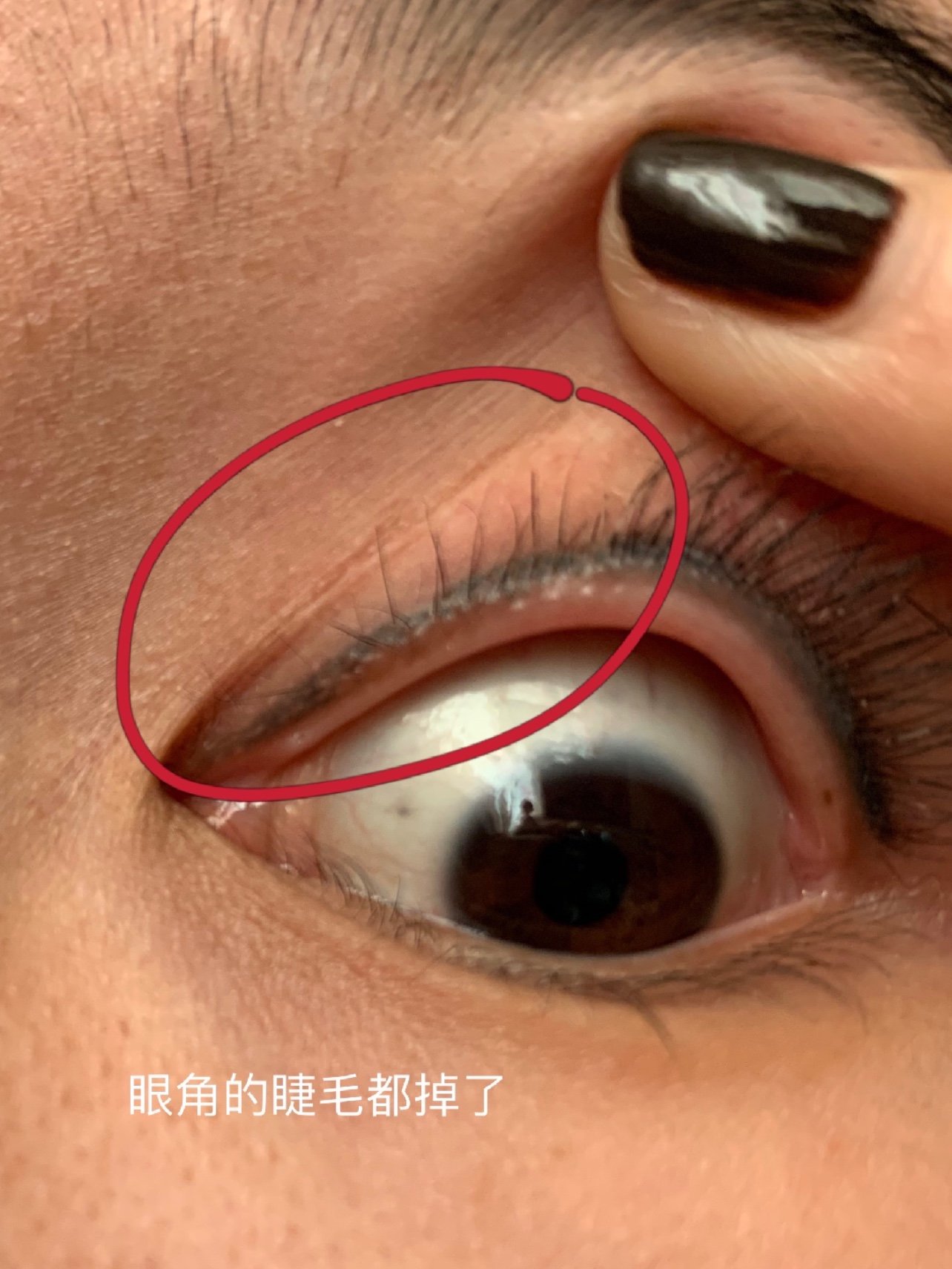 效果可以说是几乎没有,我说洗了眼线朋友说和洗之前没_圈子-新氧美容