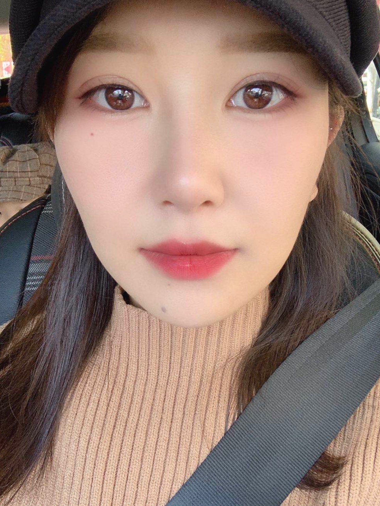 做完单萌芽鼻已经三十天了,第一个恢复月过去了,外表_圈子-新氧美容