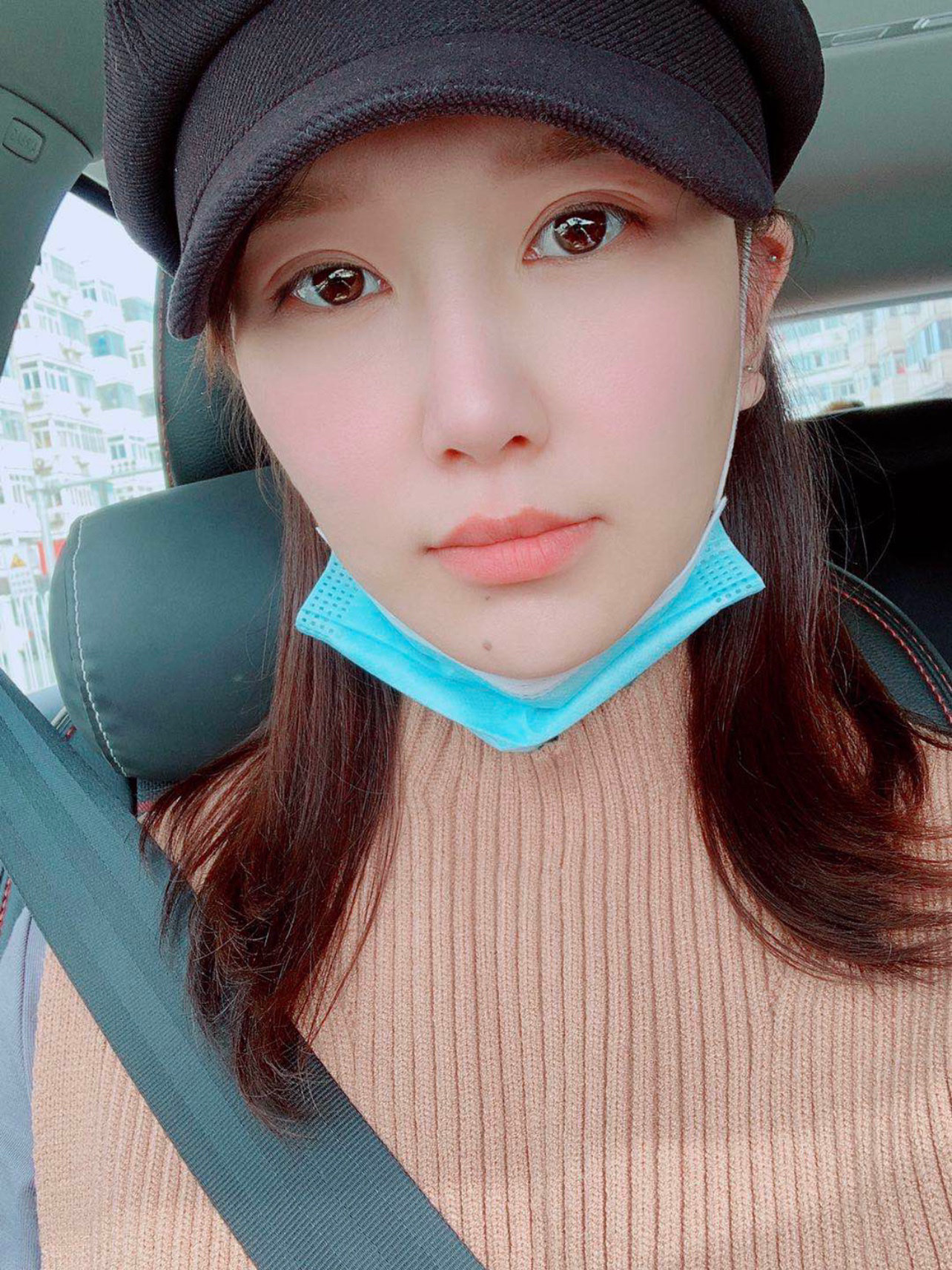 做完单萌芽鼻已经三十天了,第一个恢复月过去了,外表_圈子-新氧美容