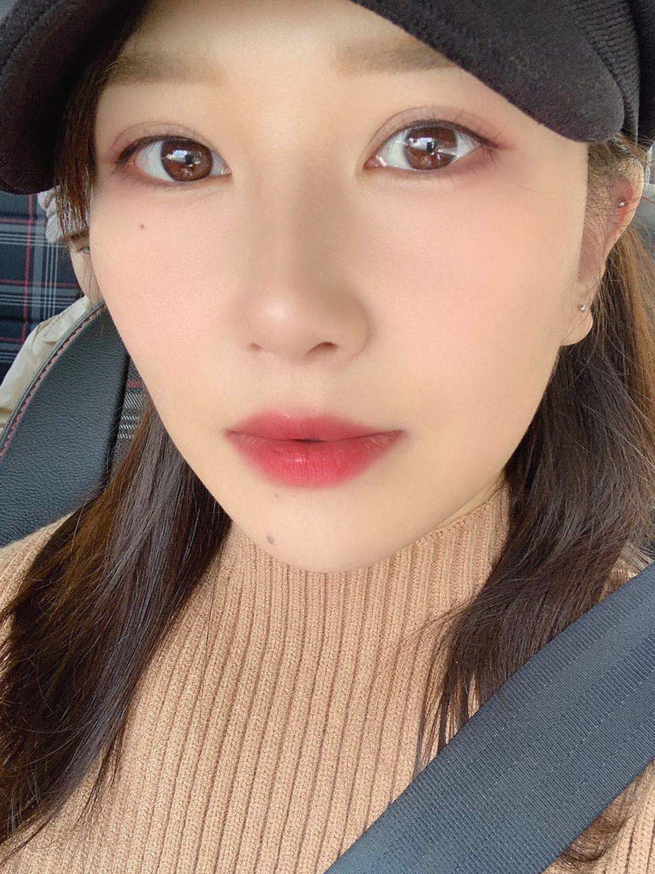 做完单萌芽鼻已经三十天了,第一个恢复月过去了,外表_圈子-新氧美容