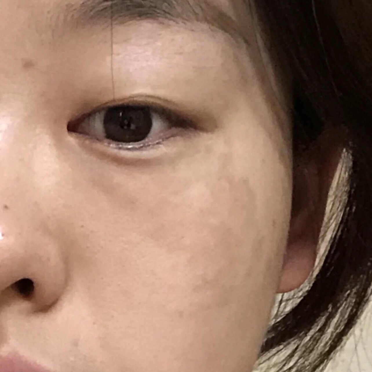 脸上有色斑真的很忧伤,显得皮肤也很暗沉,有的地方拿_圈子-新氧美容