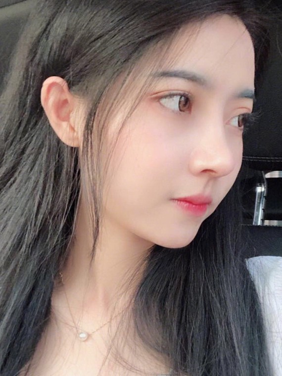 自从做完鼻子以后自拍根本停不下来,鼻子挺起来了侧面_圈子-新氧美容