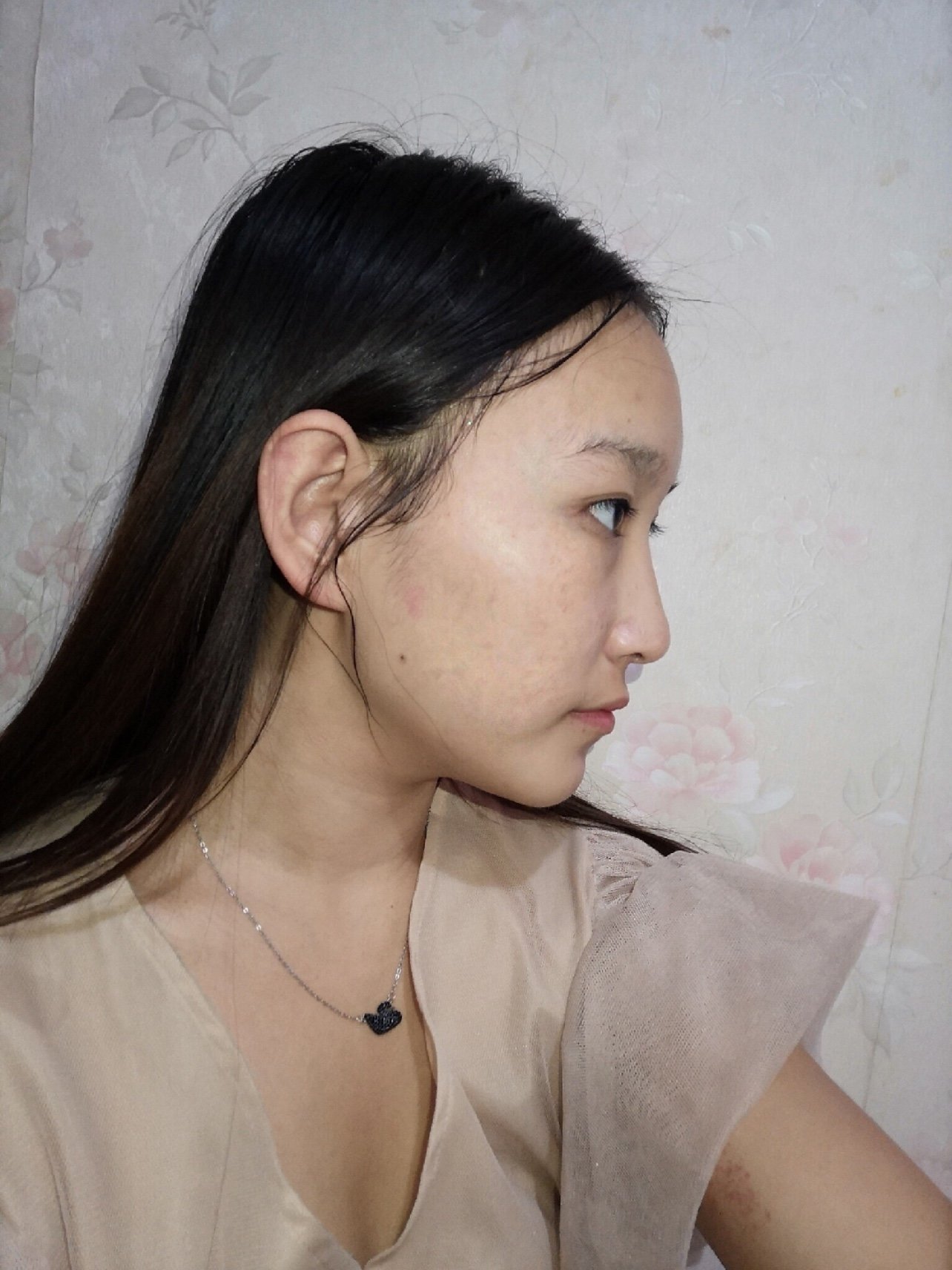 鼻子有点塌鼻尖形态不好看想做鼻子真的很久了好不容易大学的时间里存