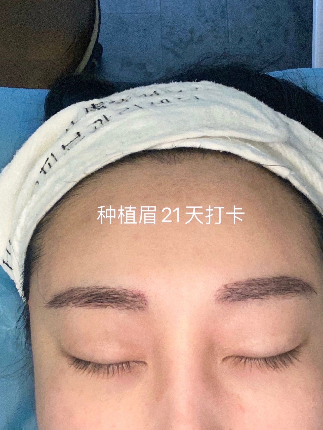 也会更加自然一些不后悔种植这个眉毛 只是后悔当初洗掉纹眉的时候