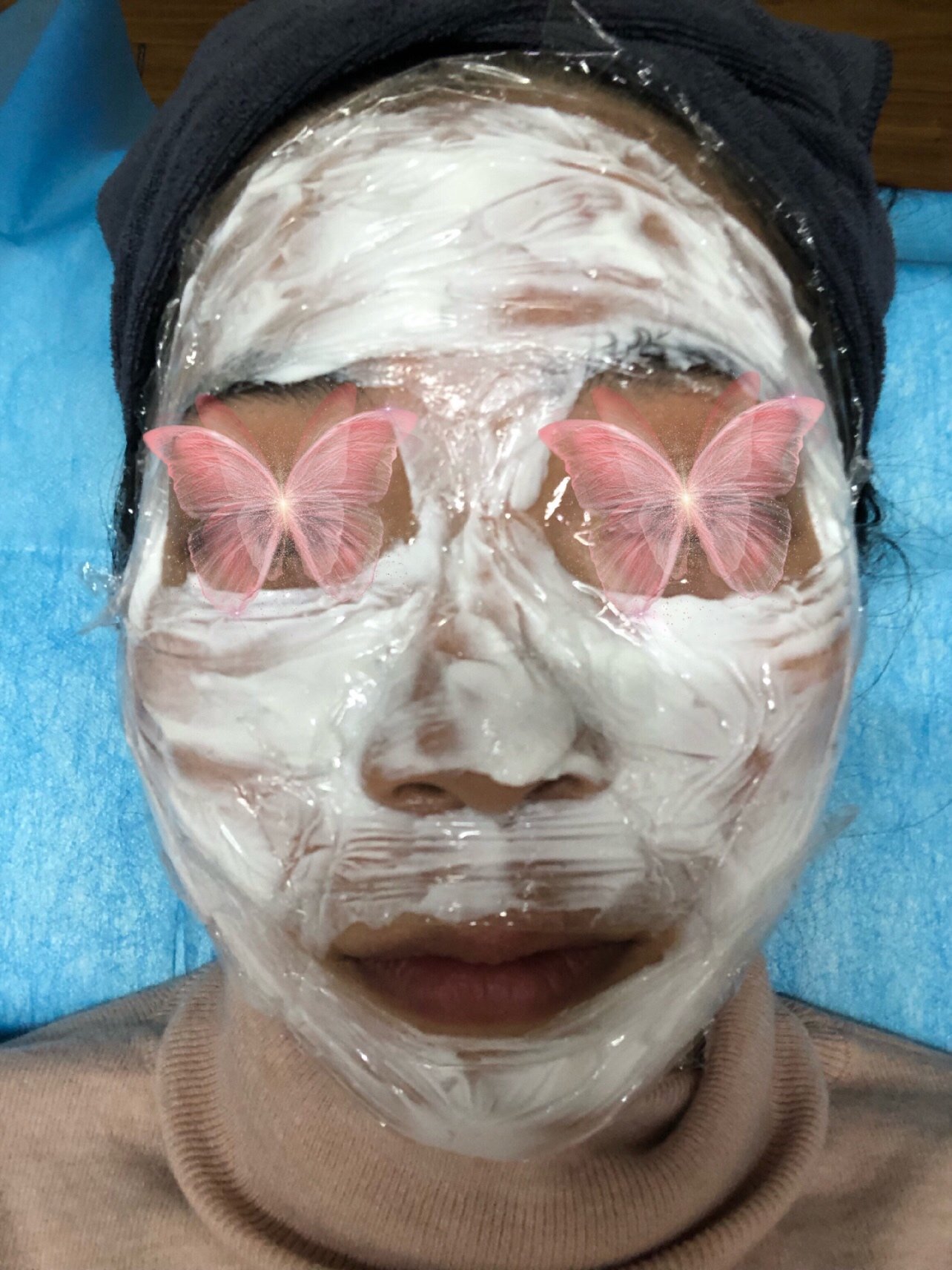 第47期新氧体验官【赛洛斯汀胶原微针初体验】