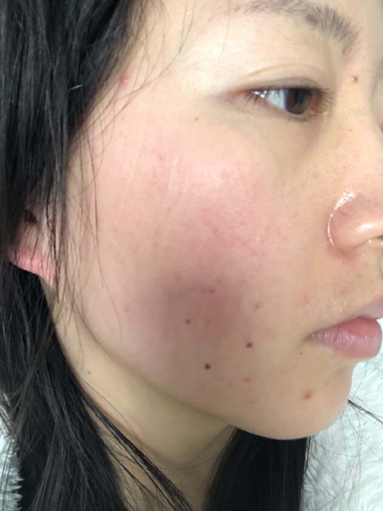 脸及其容易发红的人,稍微一点点情绪波动我就能胀得满脸通红,为此