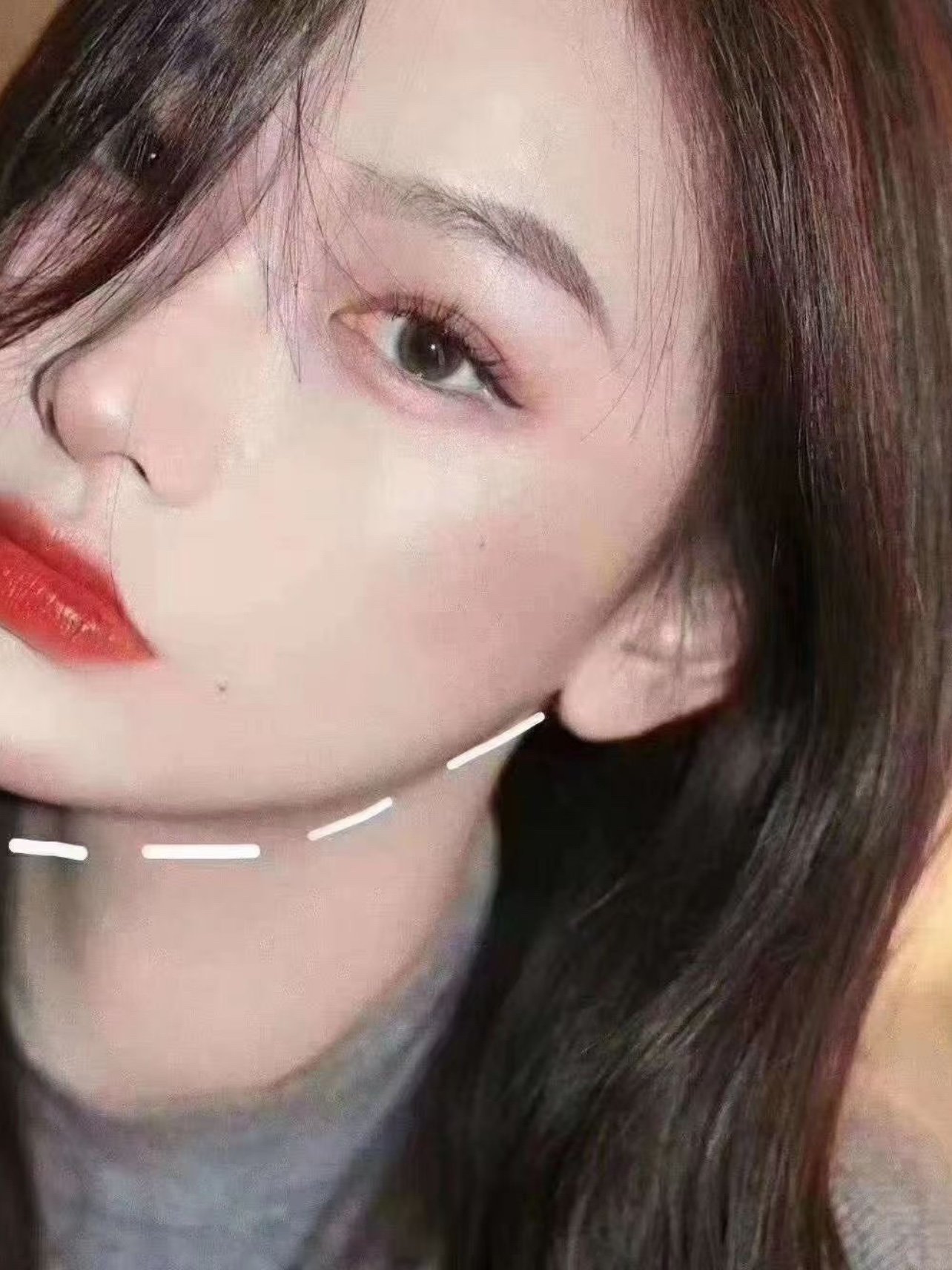 下颌缘线 又称:少女线