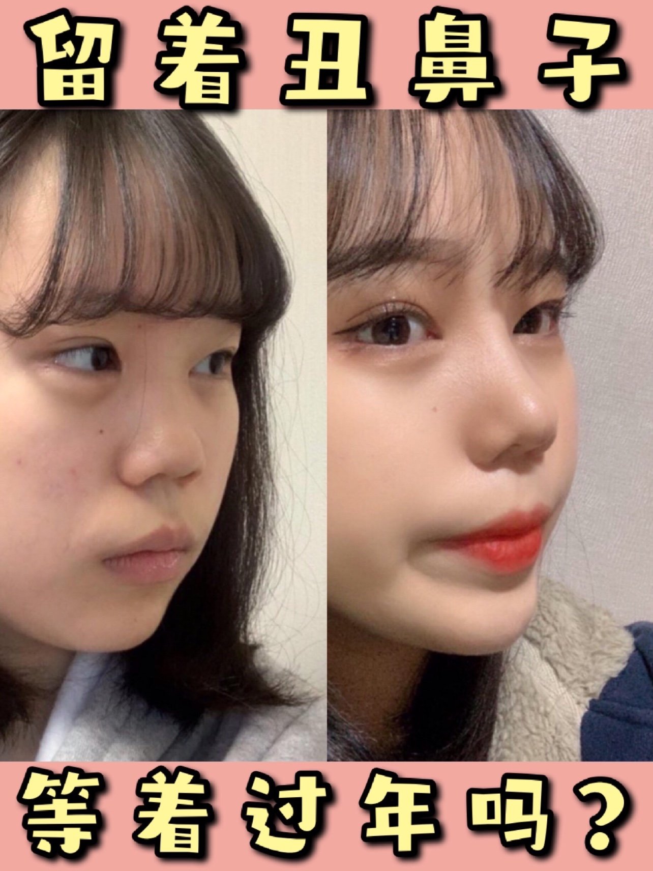 留着塌鼻子是准备回家过年吗