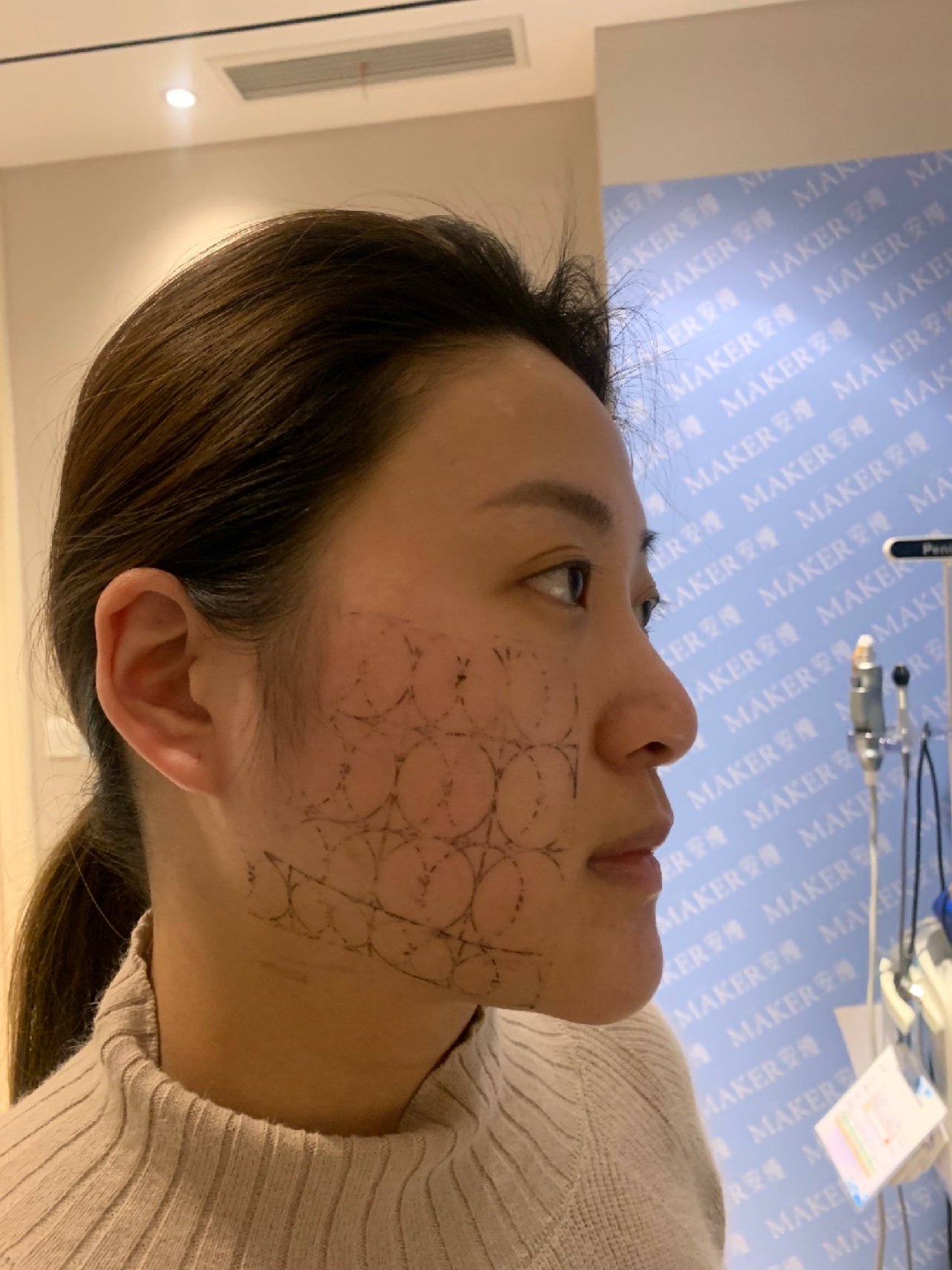 热提拉plus 7天反馈来啦!