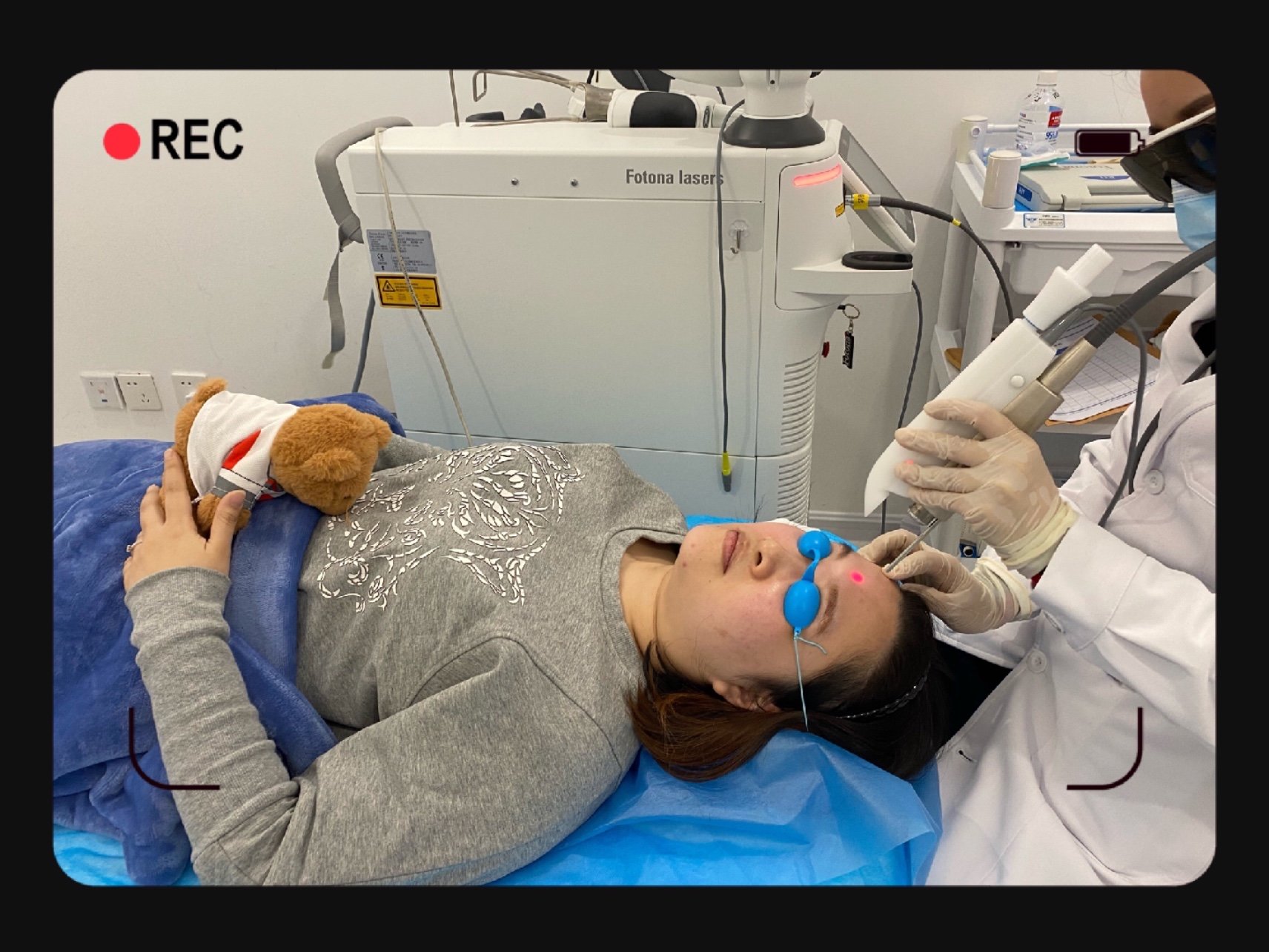 新氧试用官fotona4d