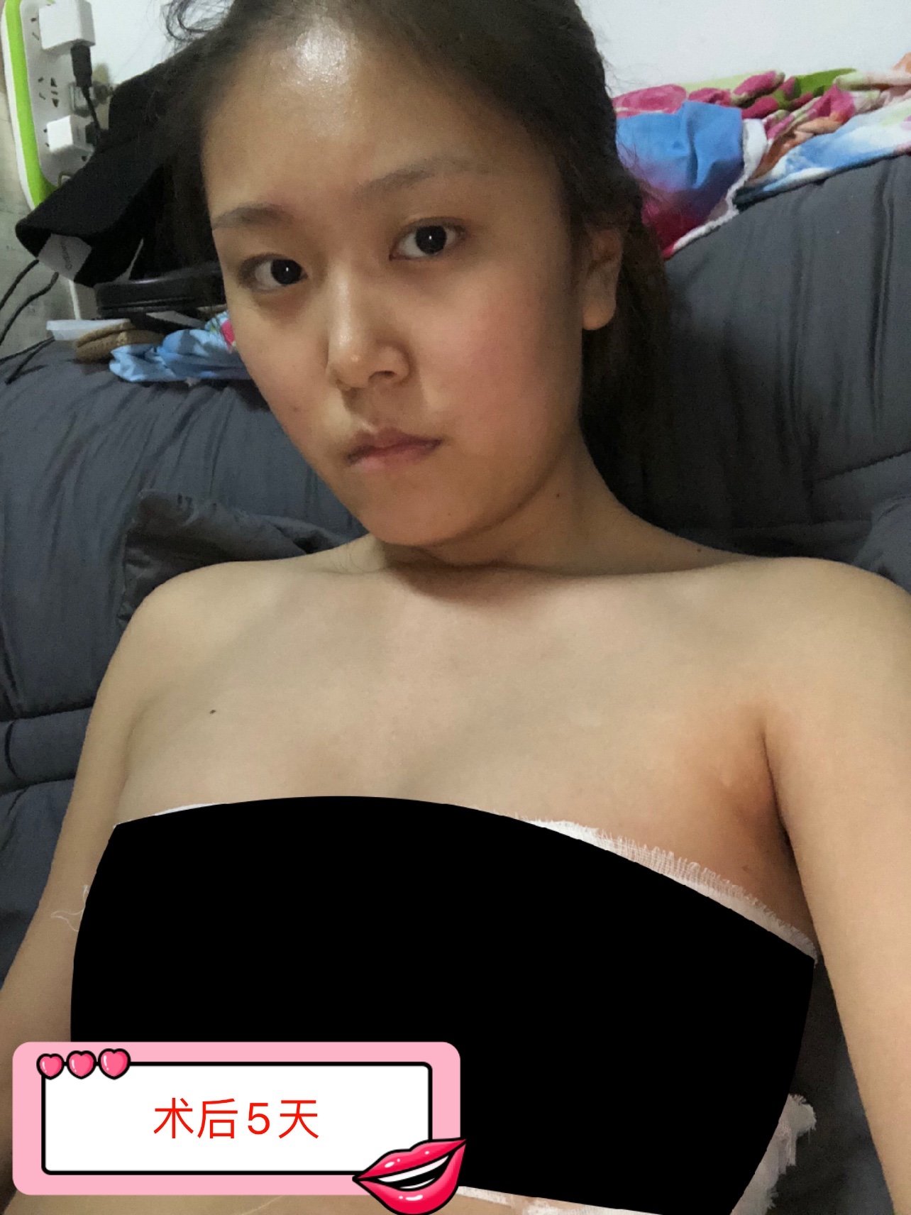 作为一个如花似玉的菇凉一枚,唯一缺点就是没有胸,我_圈子-新氧美容