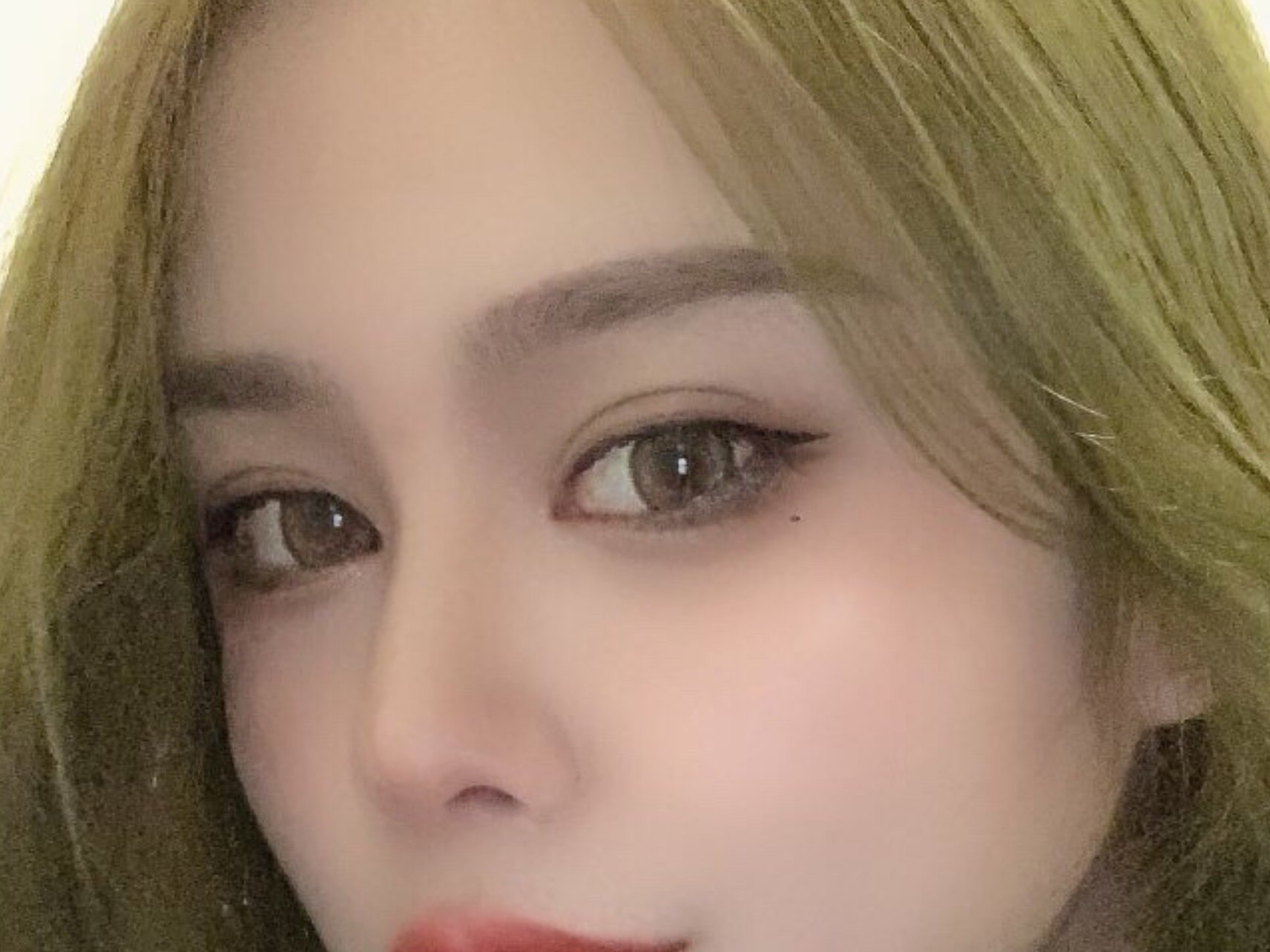 鼻子改变最大,鼻梁高了,鼻尖翘了,鼻山根也挺拔了许_圈子-新氧美容