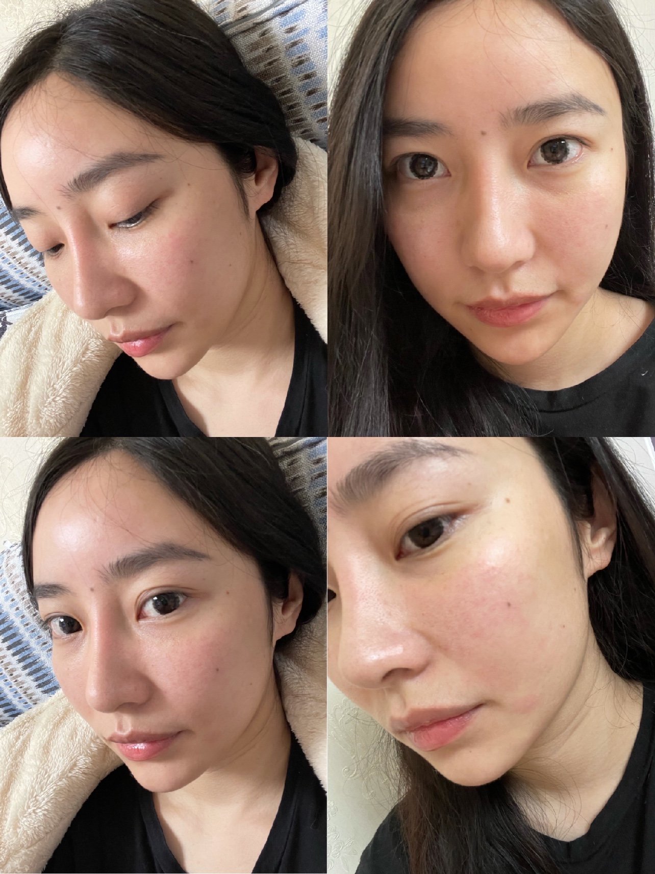 新氧试用官热拉提plus今天是热拉提第16天