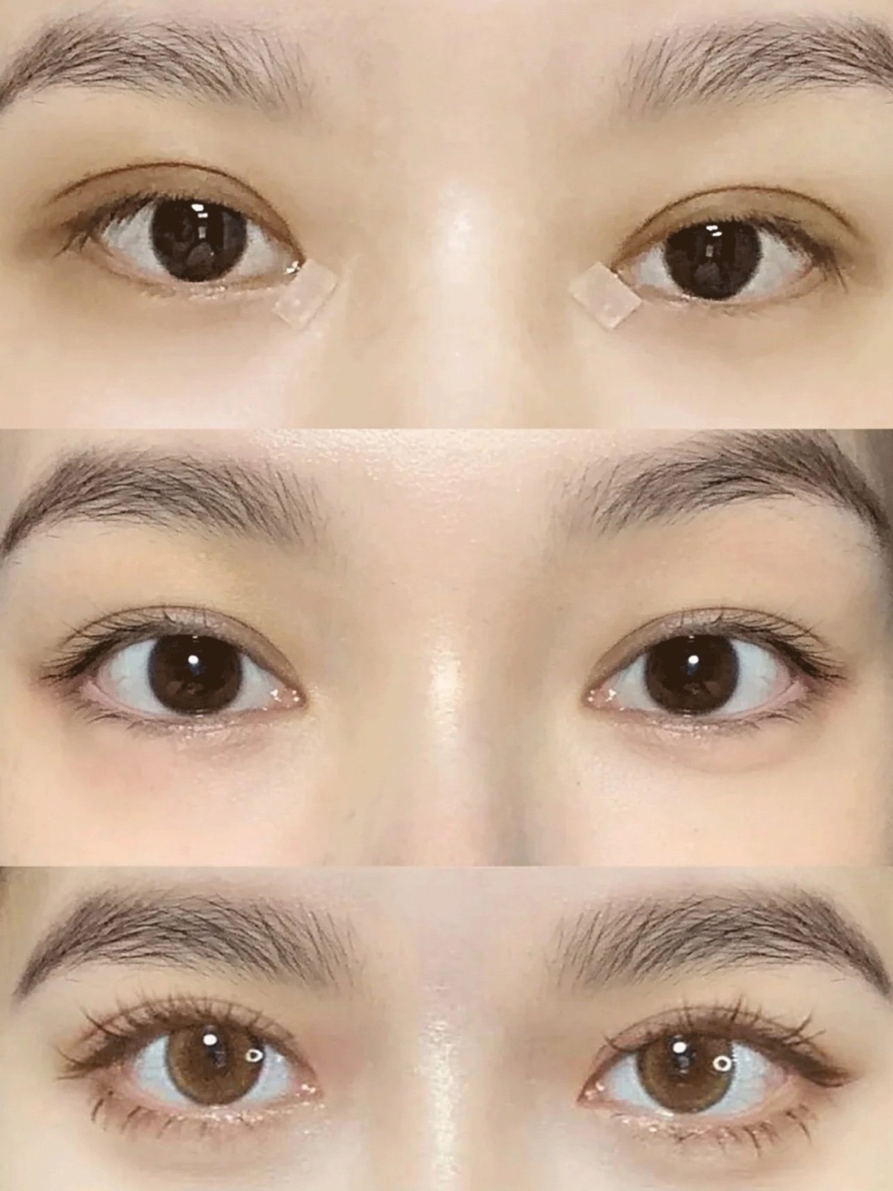 国内top10双眼皮大佬测评