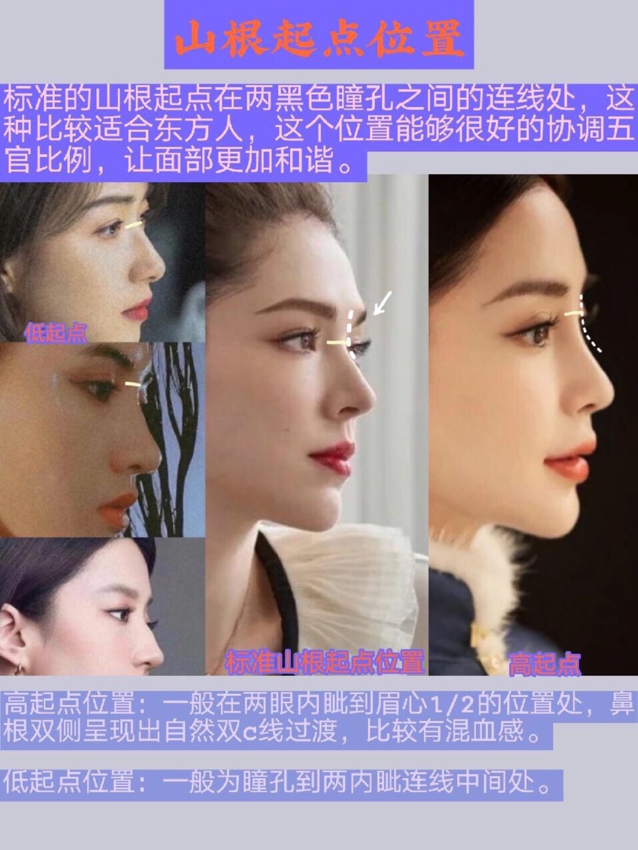 好看的鼻子要从山根开始,那么,山根怎么做才好看呢?