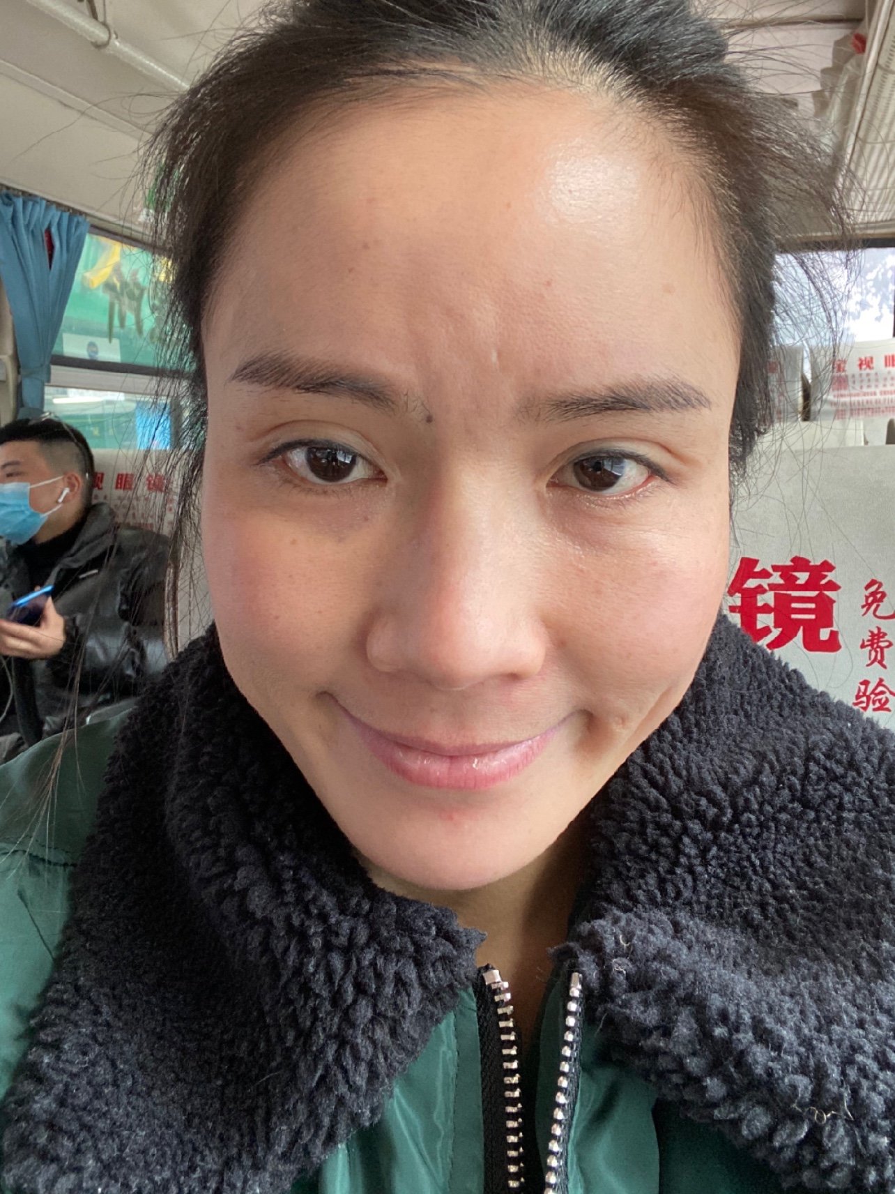 比较明显是额头有左边,不平,9615纹,图片上清晰可见_圈子-新氧