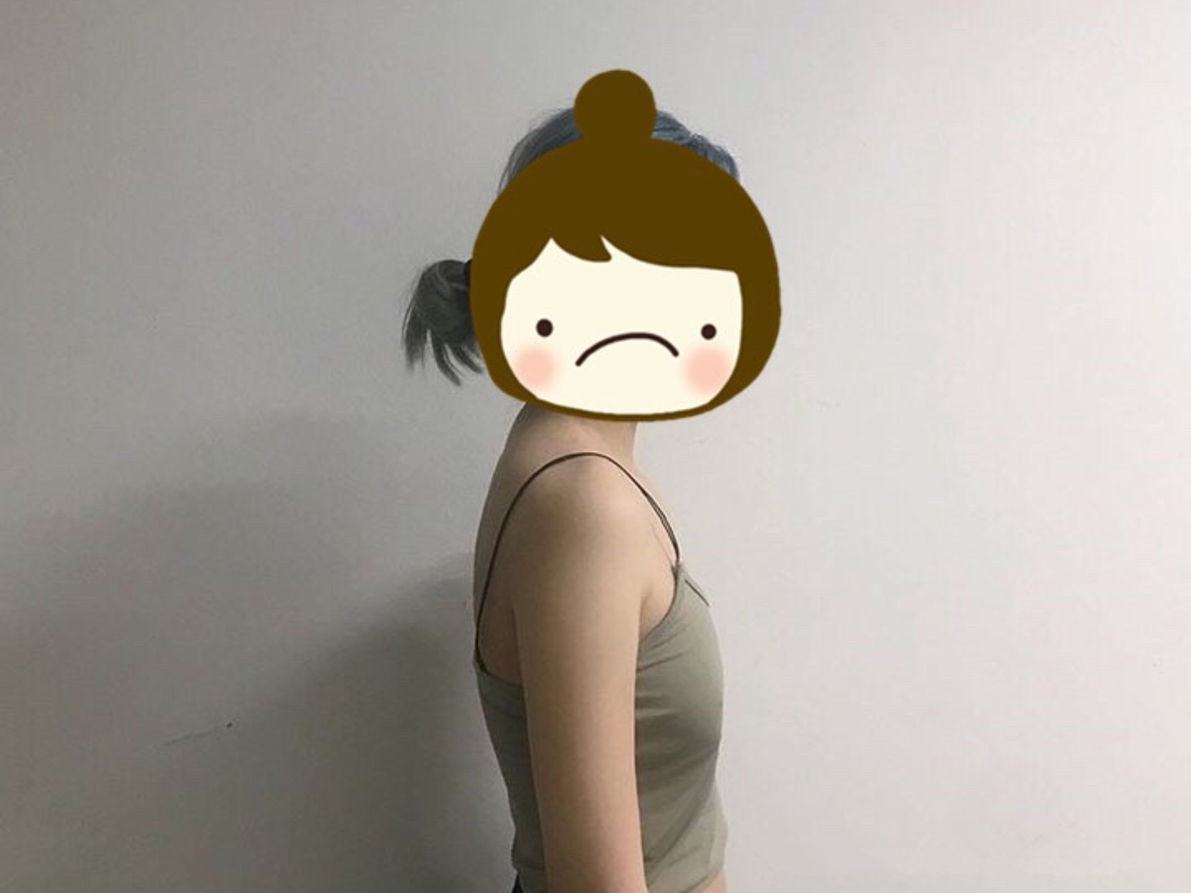 产后胸部下垂的厉害而且还越来越干瘪了为此生完孩子后就再也没有去大