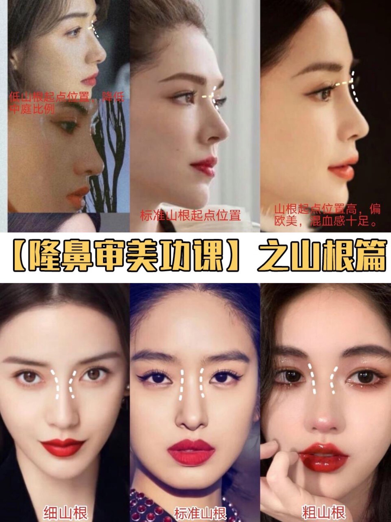 隆鼻必看山根到底怎么做才好看?