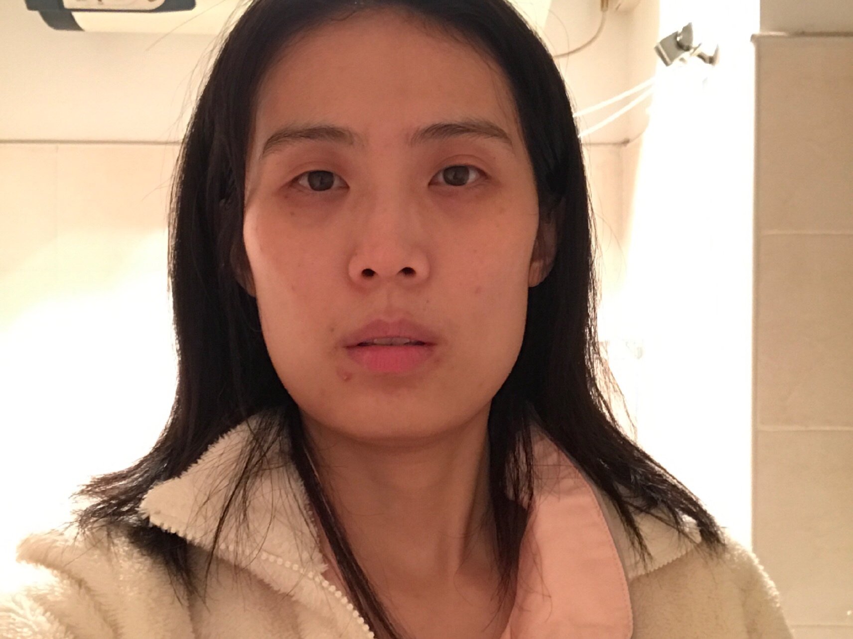 腮帮子疼下巴比之前宽了脸更扁了01