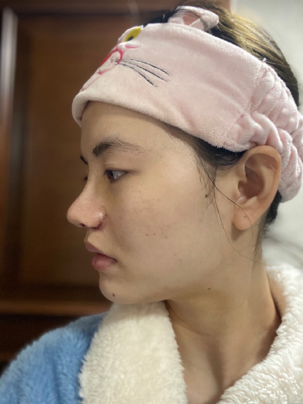 侧面弧度翘得吓人,每个看到我的都说怎么鼻头那么翘.