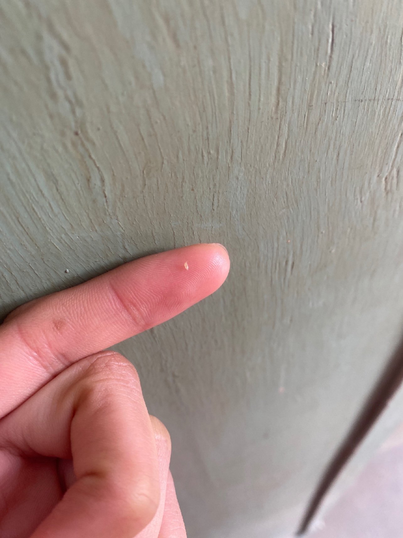 脑门上挤出来的挤出个洞00