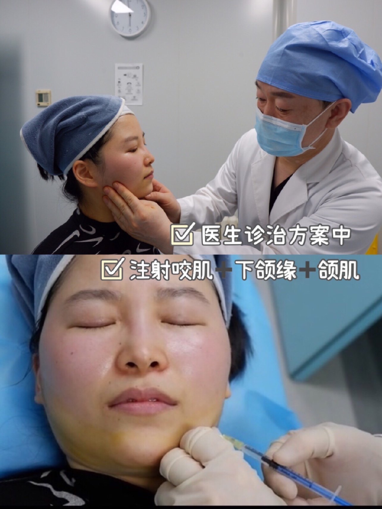 你要偷偷变美,惊艳所有人听说吃货的咬肌都不小,说_圈子-新氧美容