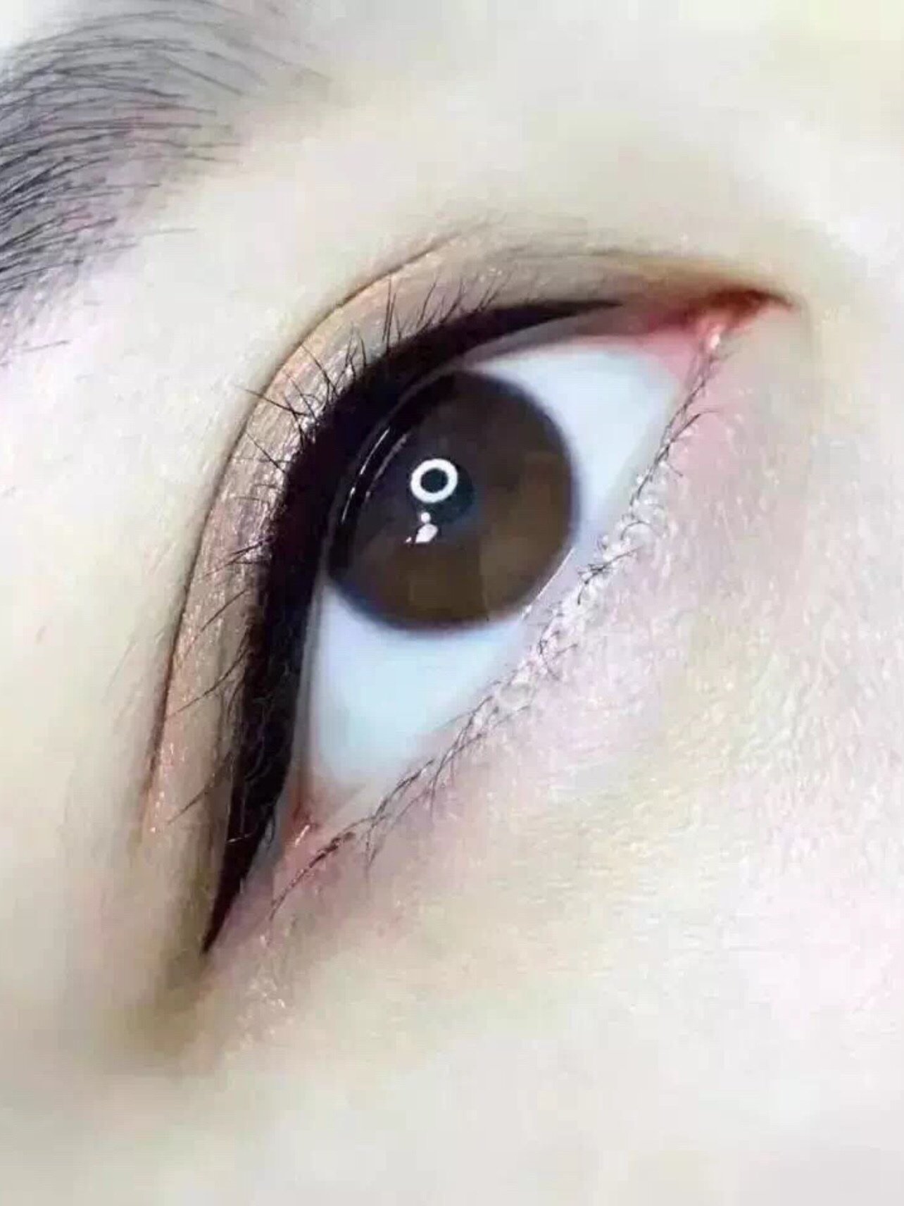 防范黑医美,不做牺牲品有些小姐姐不知道美瞳线和眼_圈子-新氧美容