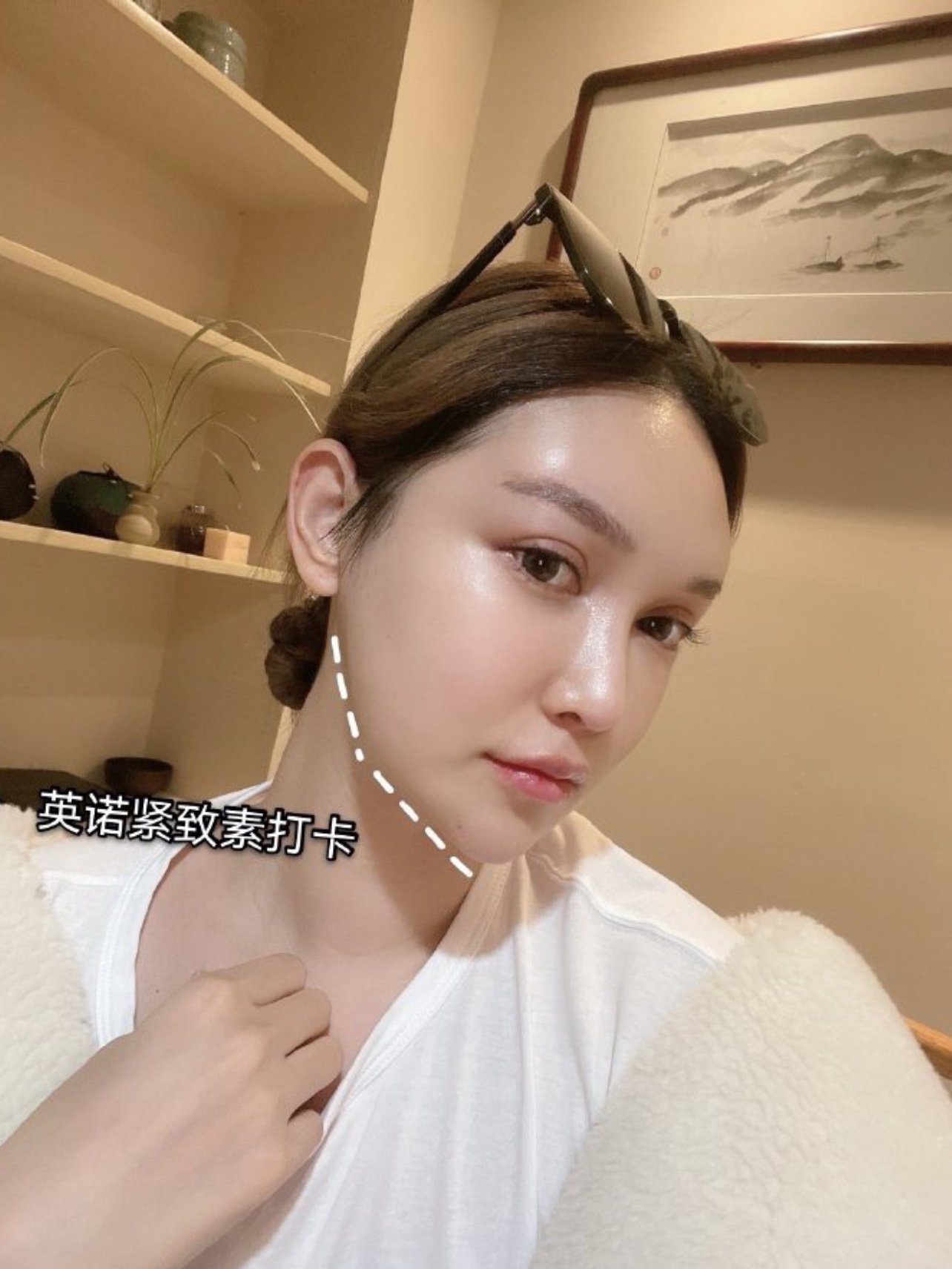 01打卡液态热玛吉|下颌缘提升黑马【abby英诺紧致_圈子-新氧美容