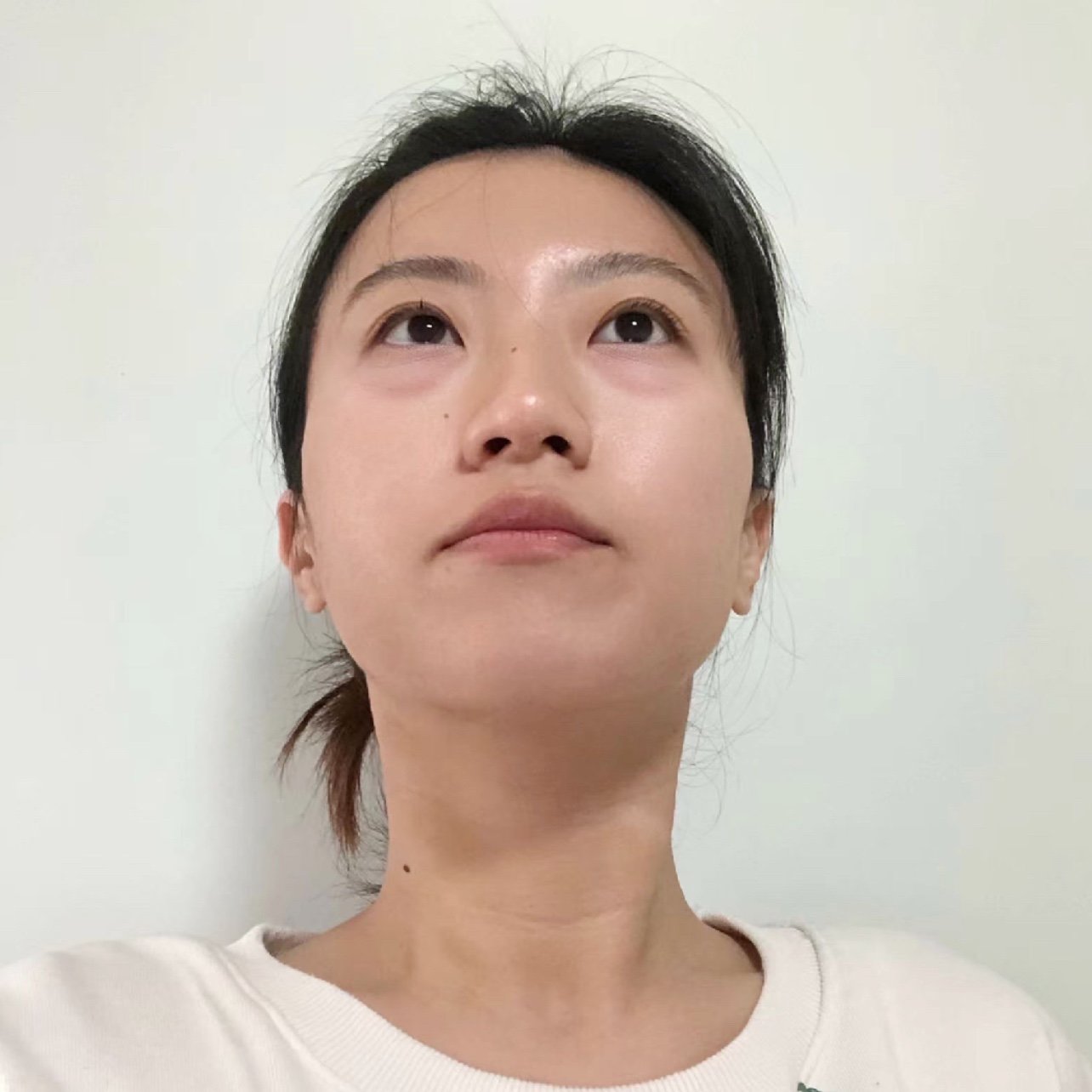 07我的卡姿兰大眼袋消失术07