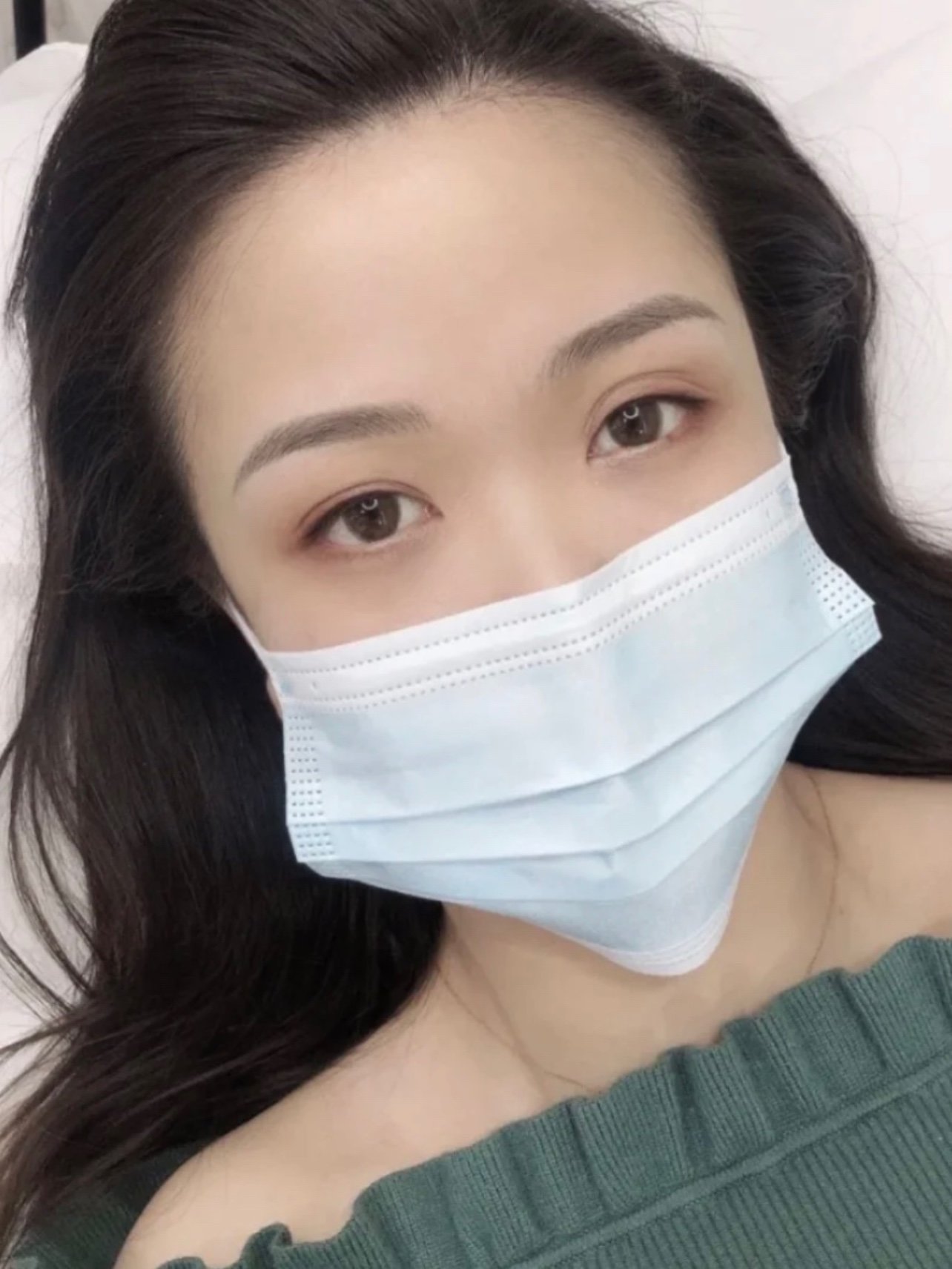 我纹的是根眉中的一种丝影眉,这款眉毛根根分明,非常_圈子-新氧美容