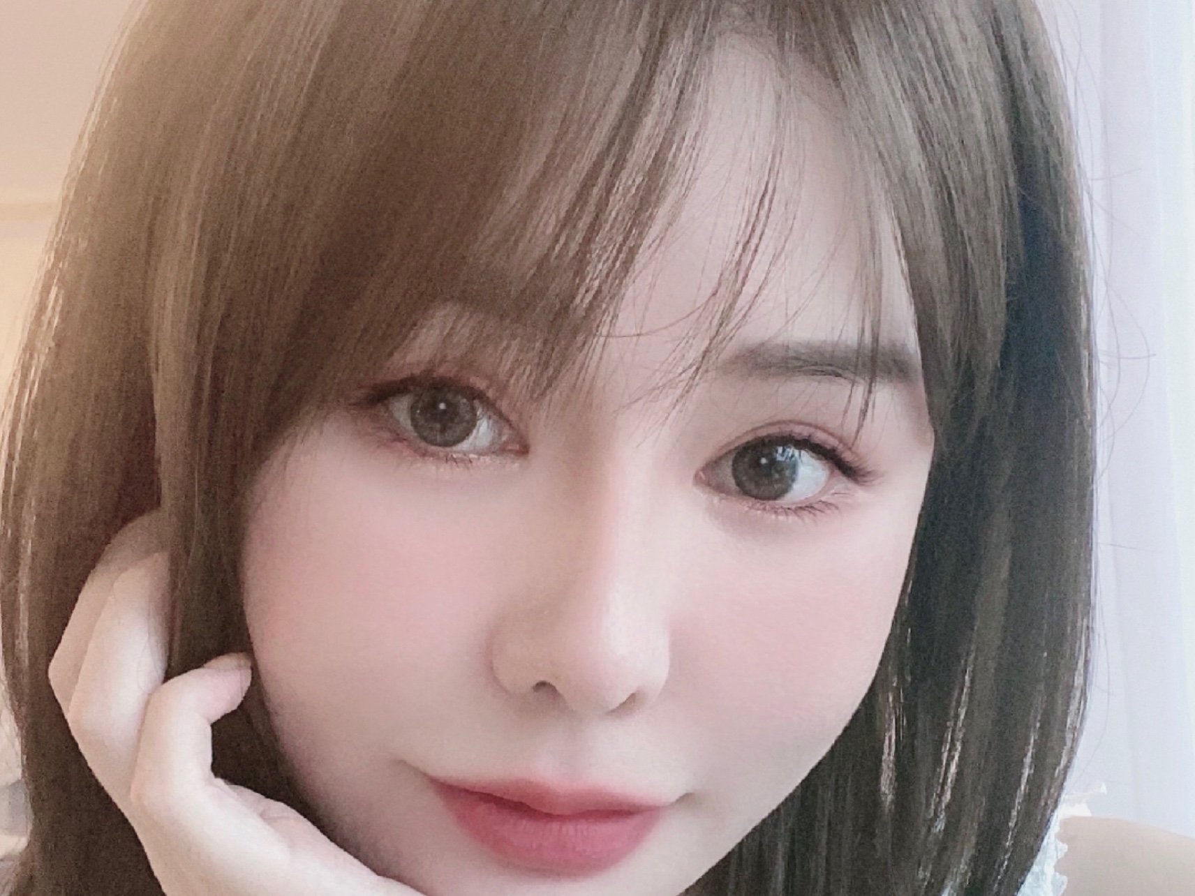 【玻尿酸】乔雅登 voluma 1ml ,乔雅登雅致/极致/丰