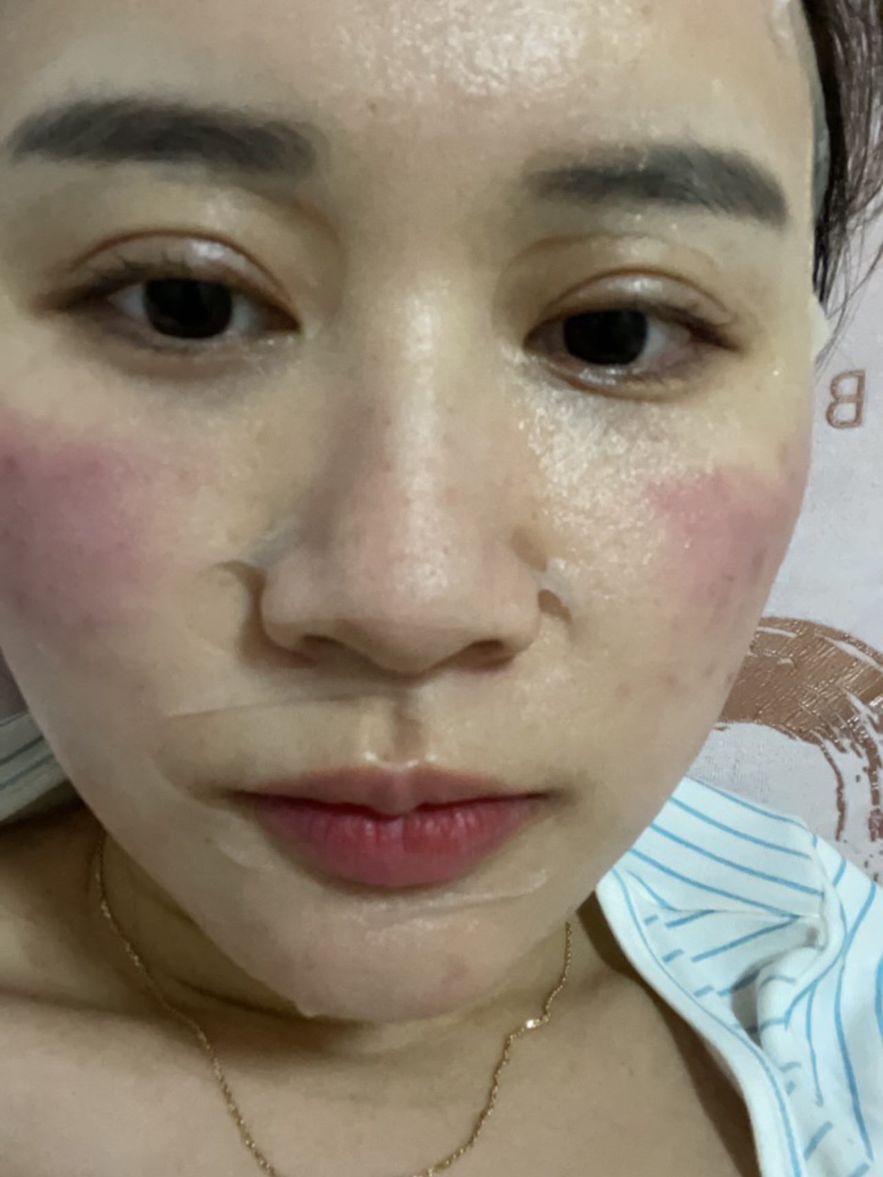 混合油皮,敏感,红血丝,痘痘痘印痘坑,总结出来就是肌肤状