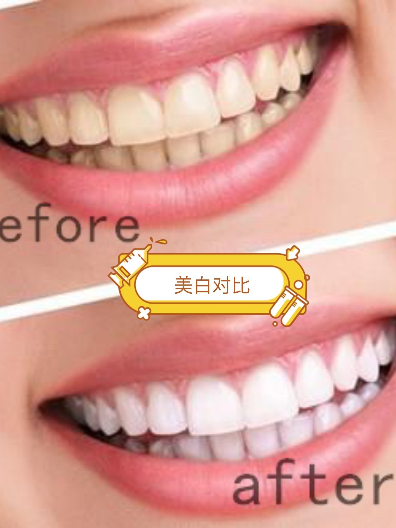 牙齿美白有"绝招"