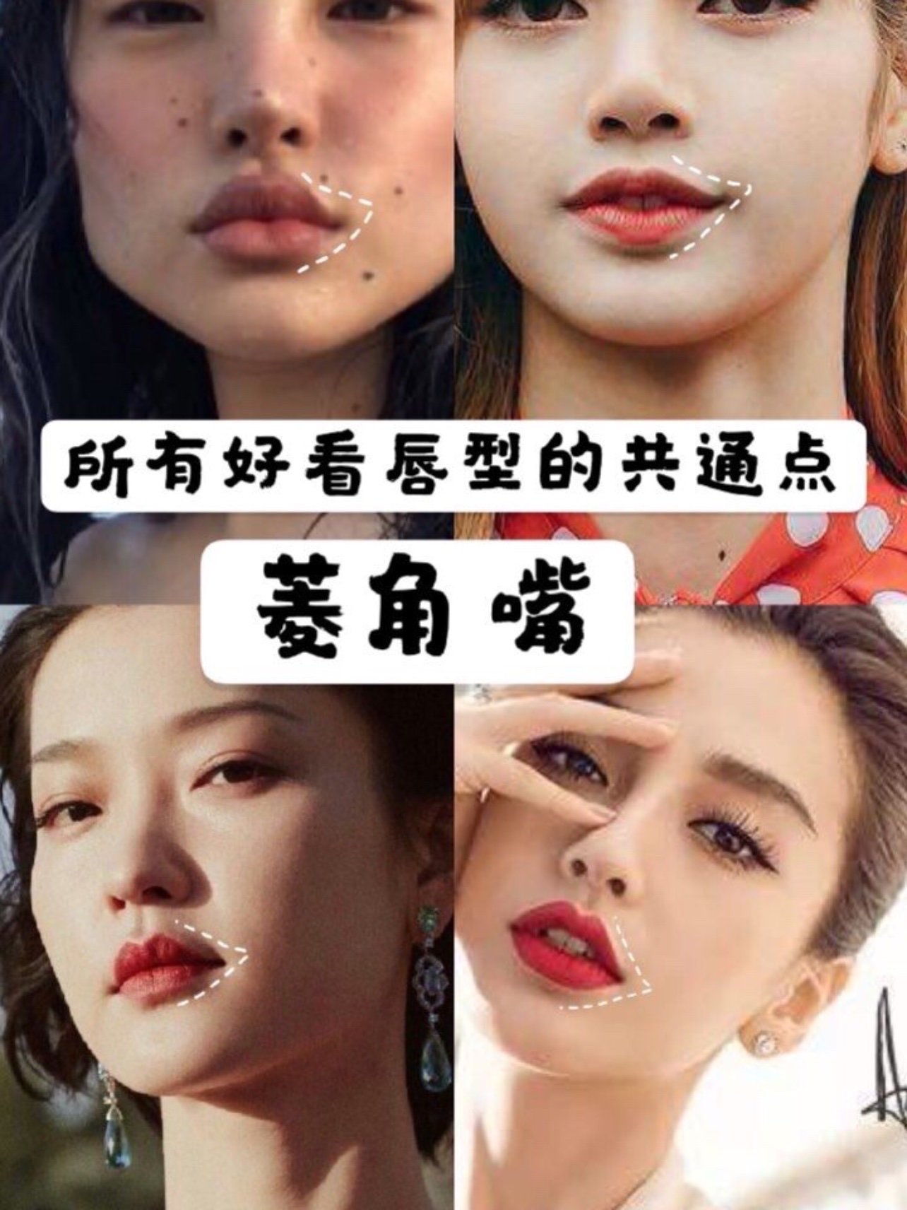 扁圆唇到口如菱角 微笑唇案例