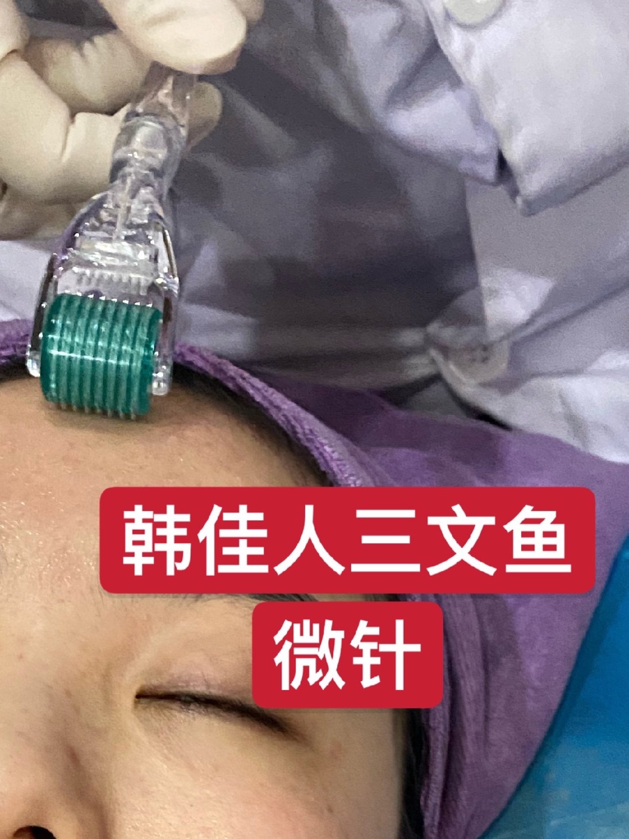 这次体验的是韩佳人三文鱼是用微针的形式来使用的