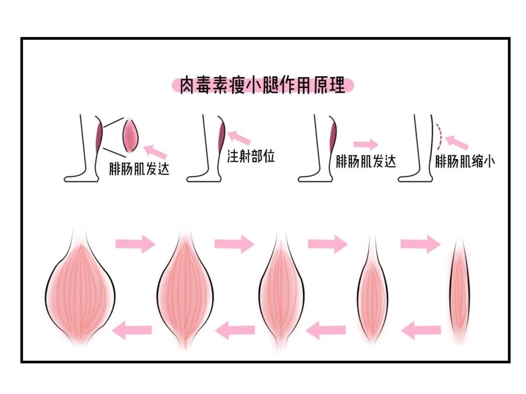 787878女生都希望自己拥有一双纤细美腿,特别是自带"_圈子-新氧