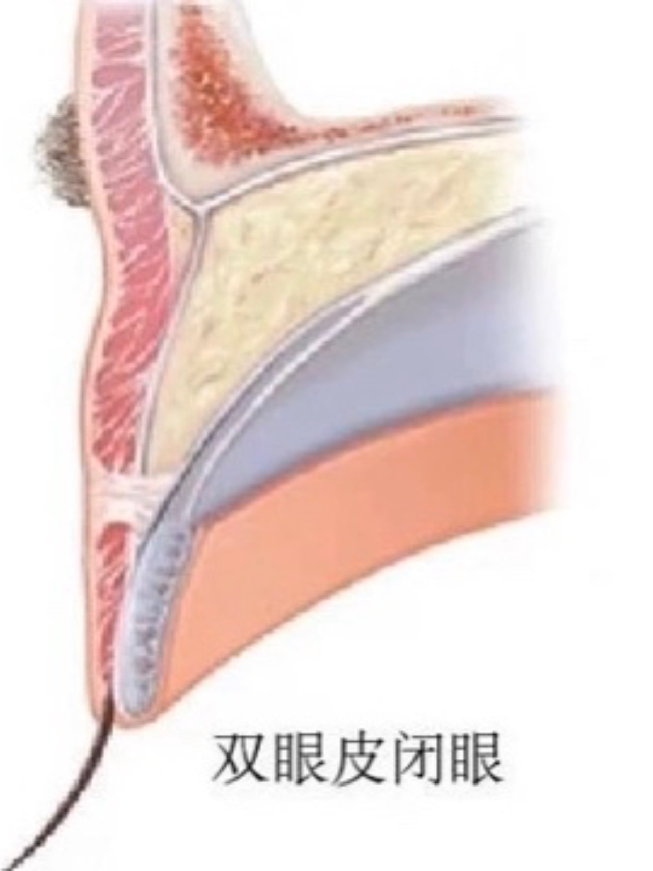 99双眼皮的形成原理929292只有搞清楚这个,你才能知道_圈子