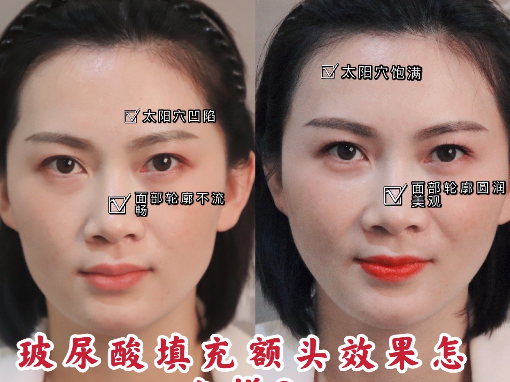 "天庭饱满"能让我们显得更自信跟动人,有的人甚至把饱满的额头看成