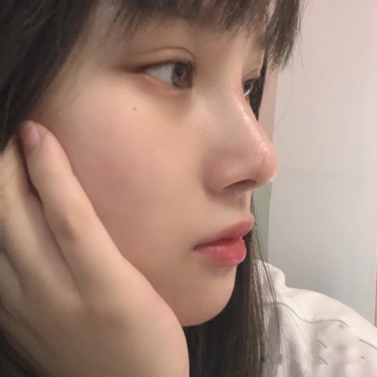 现在的鼻子我太满意了,挺翘有型,侧脸杀也完全hol_圈子-新氧美容整形