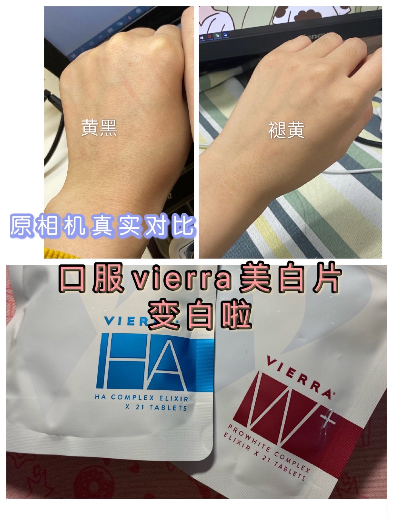 普天同庆俺变白了