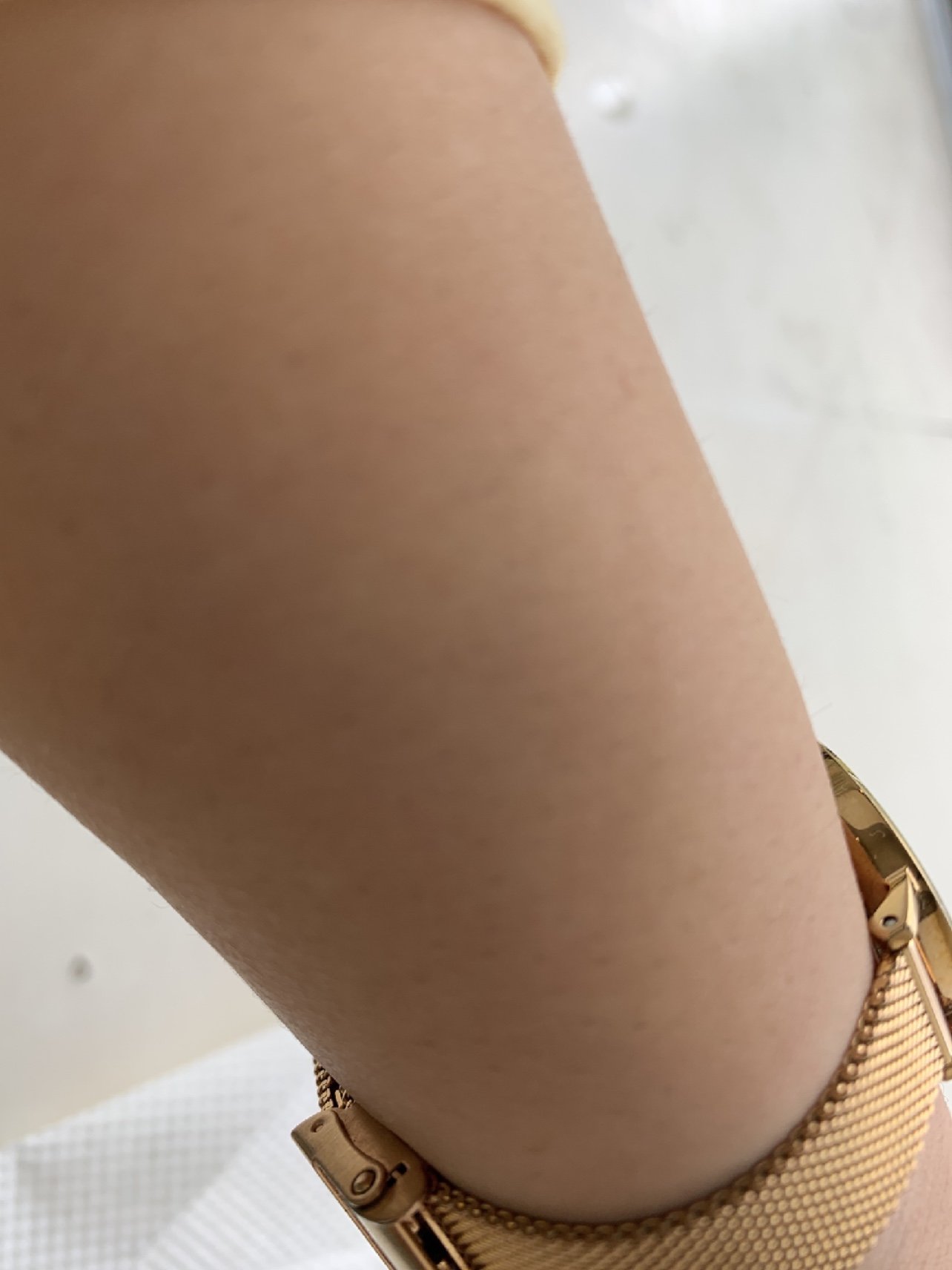 现在第15天手臂有细细毛发长出来但很短并且软软的期_圈子-新氧美容