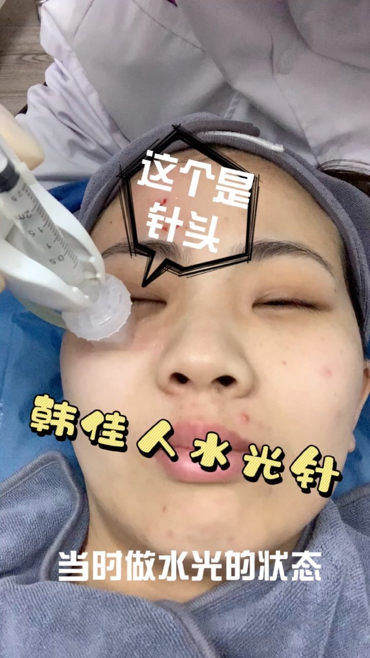 新氧试用官韩佳人三文鱼微水光
