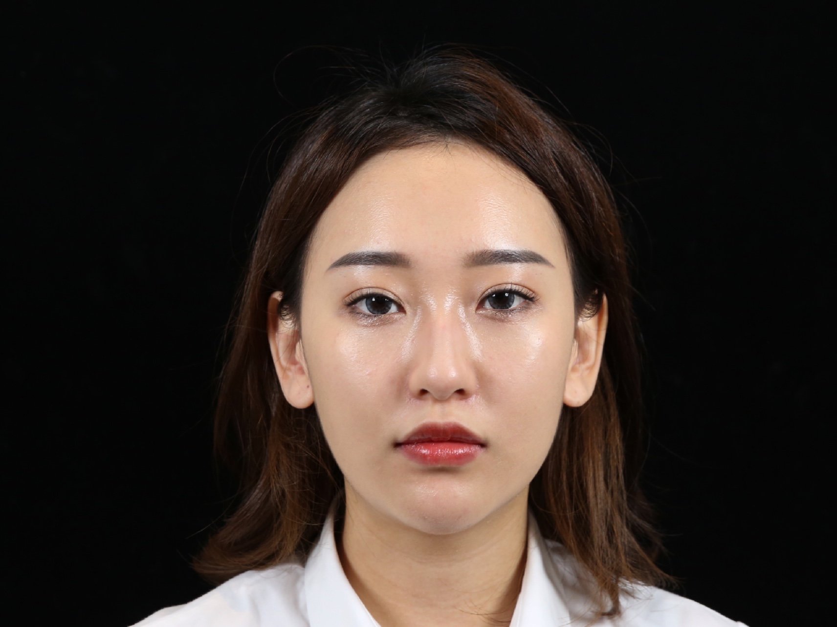 法令纹,嘴角纹,黑眼圈,眼袋,轮廓不清晰,双下巴