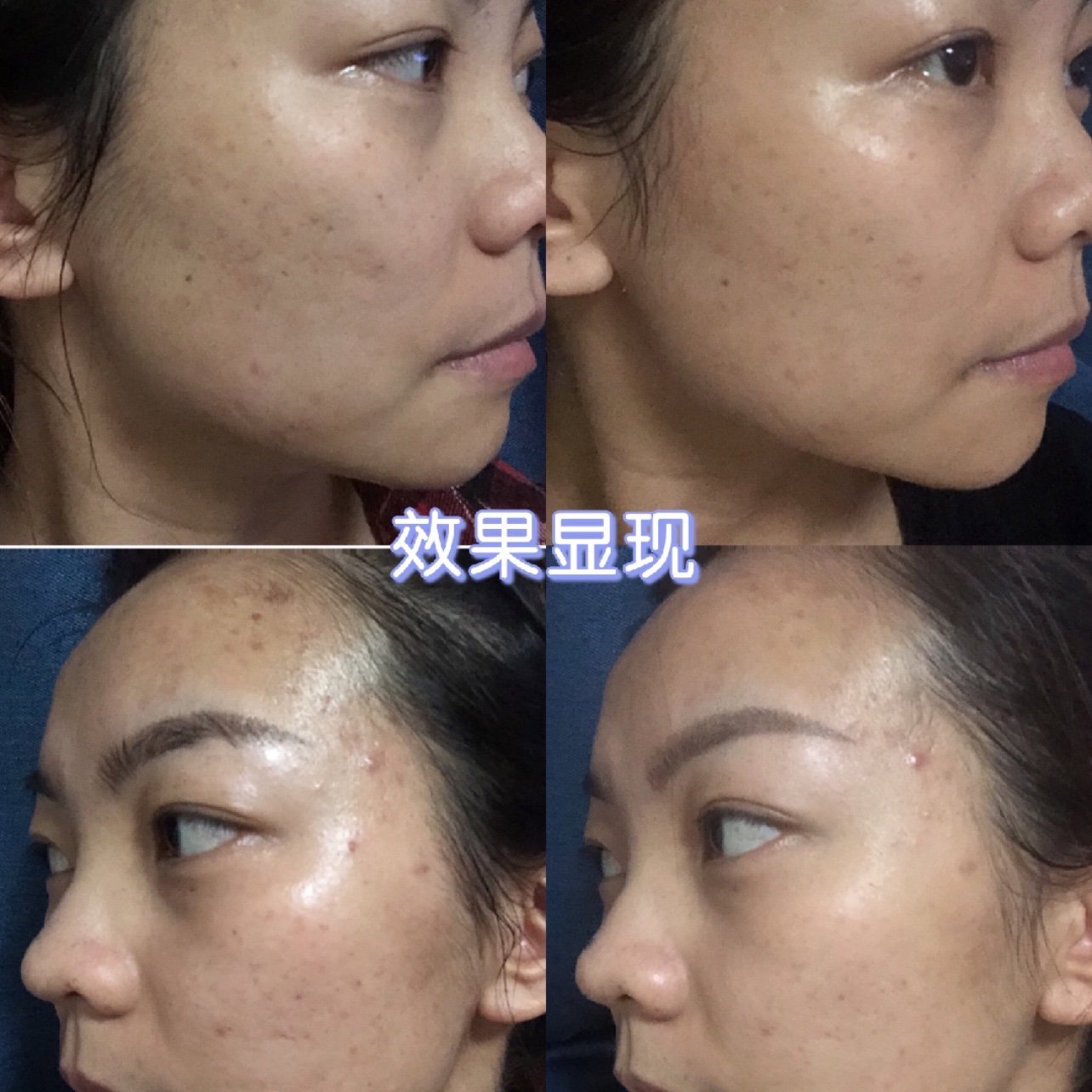 05水光后七天上图