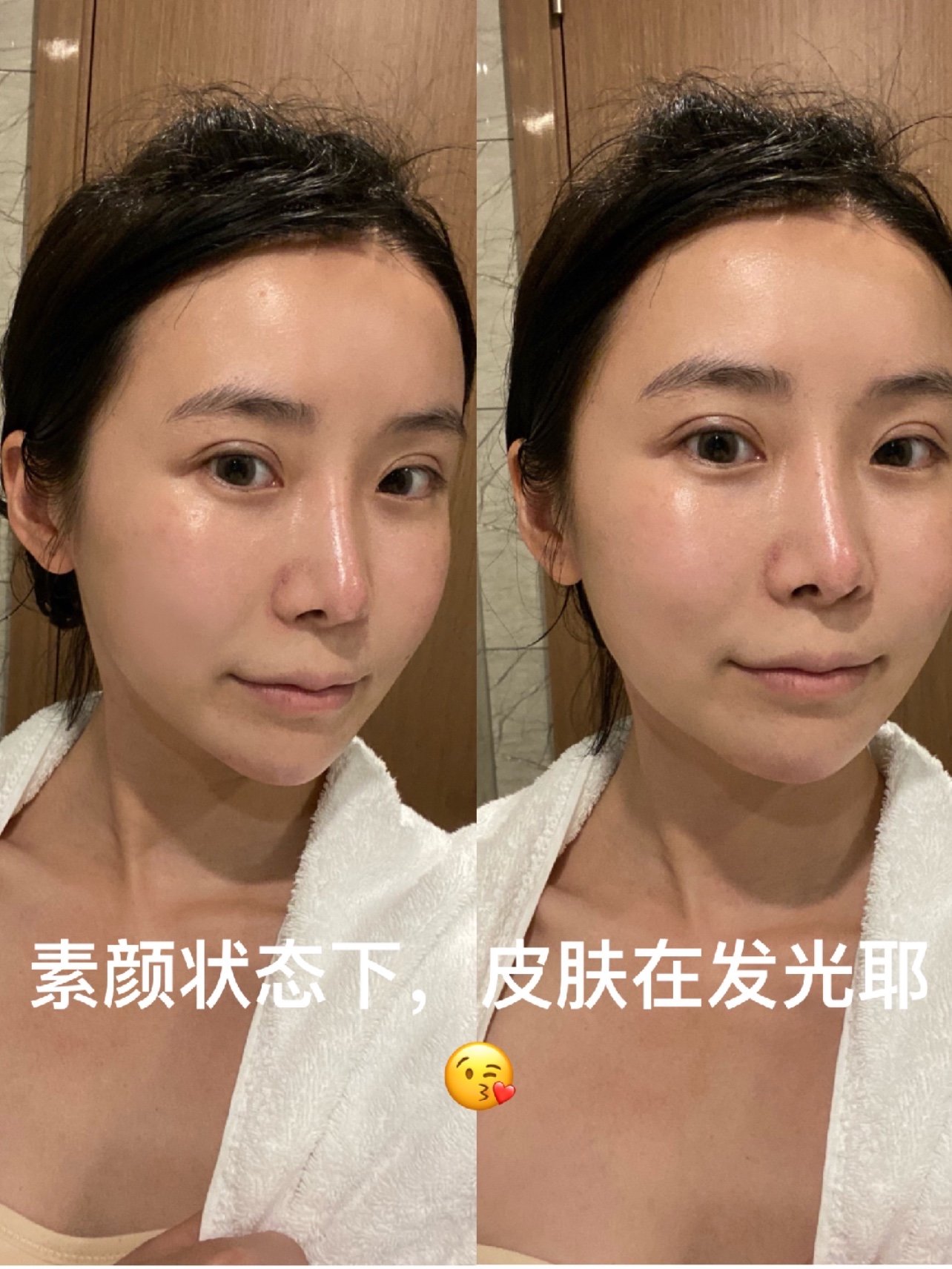 韩佳人三文鱼微水光体验日记