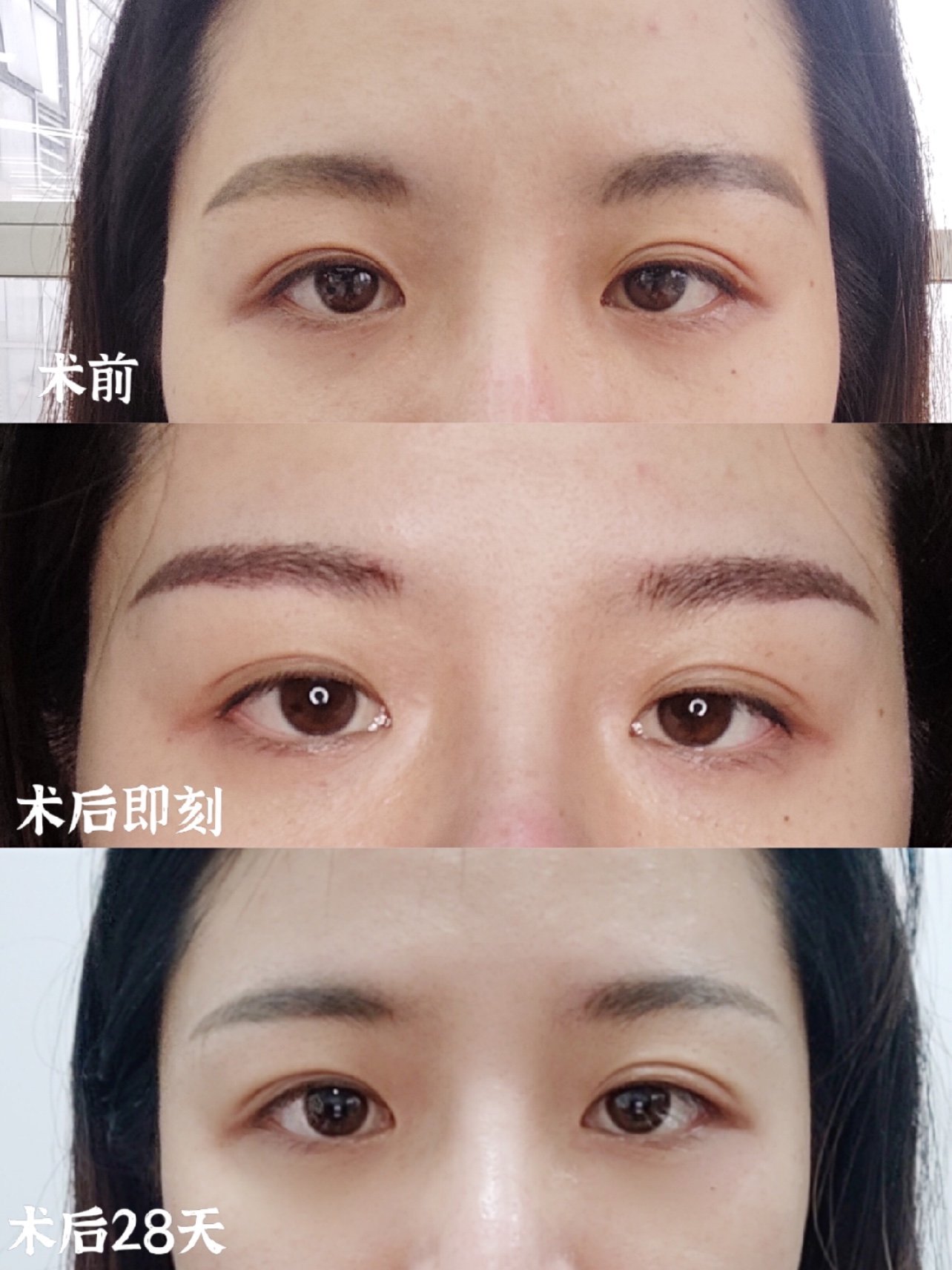 哈喽,今天是我纹眉后的28天啦!纹眉后的第一感觉就是爽!