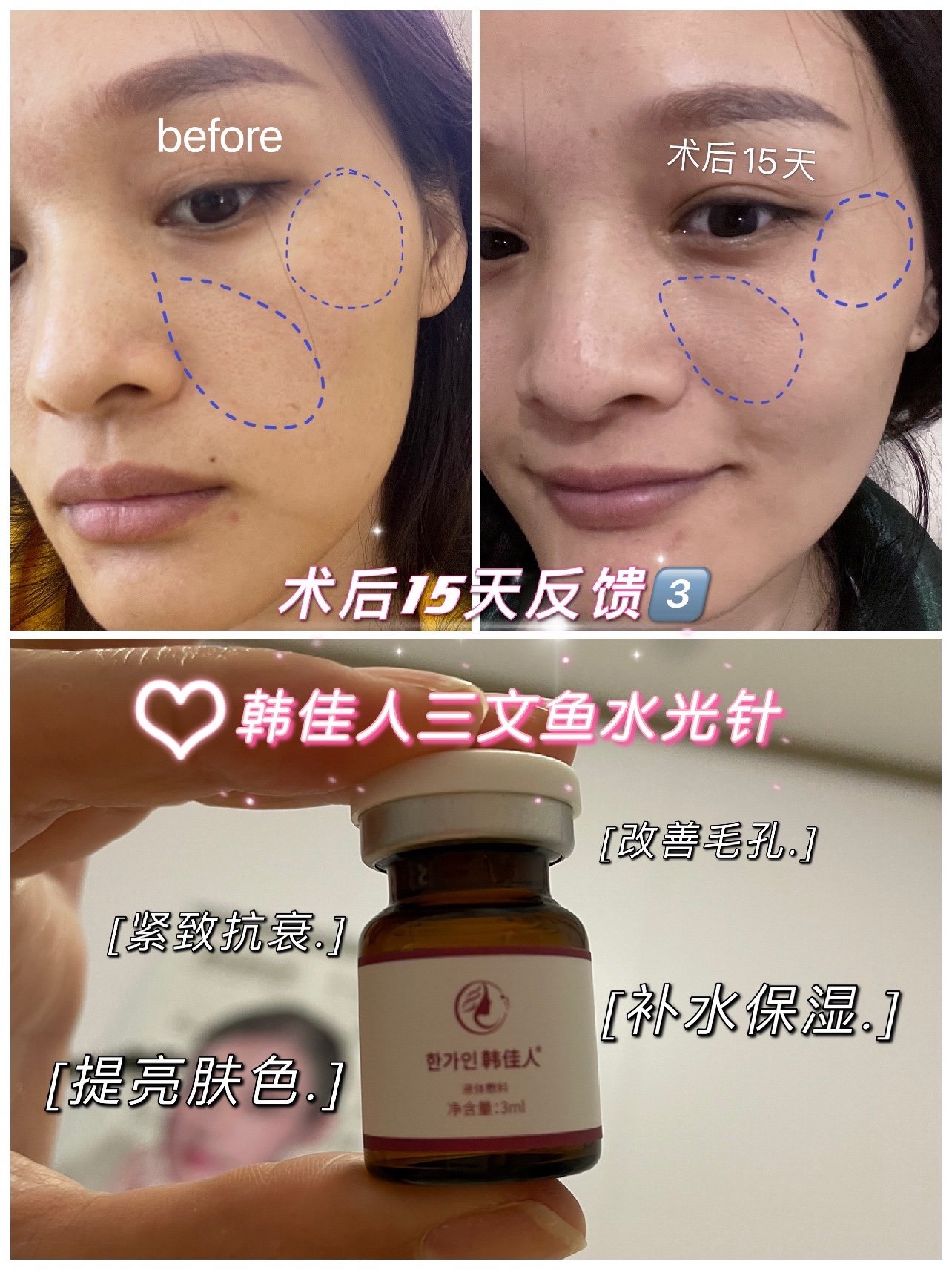 新氧试用官韩佳人三文鱼微水光 解锁15天的效果,_圈子-新氧美容招形